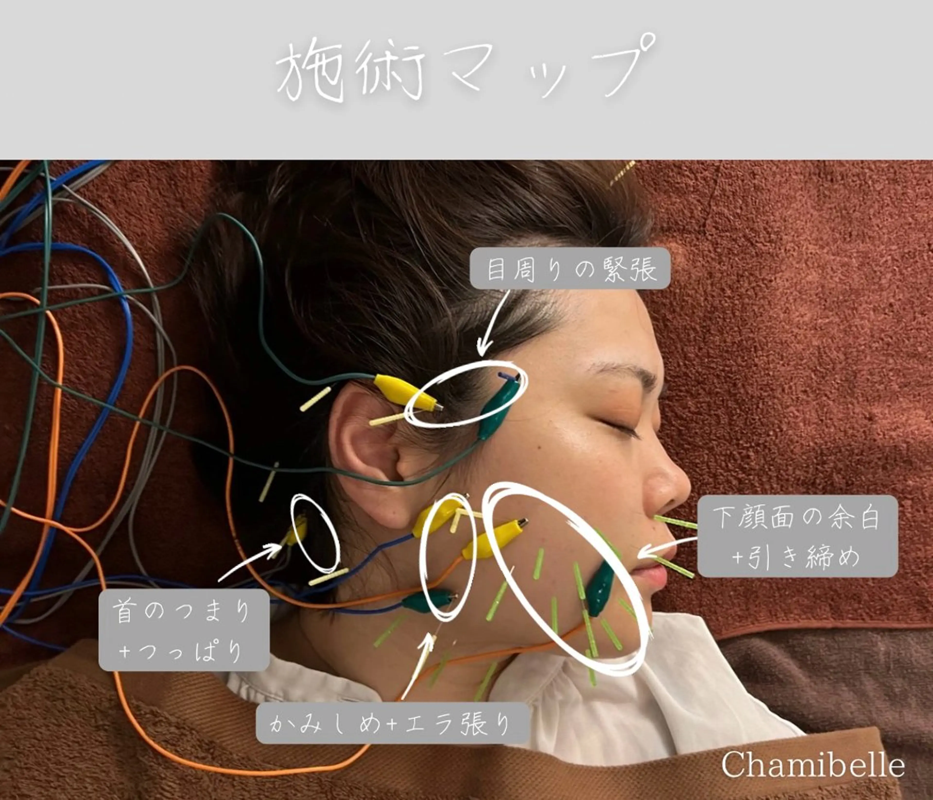 エステ リラク 美容鍼灸サロン Chamibelleのエステ・リラクイメージ