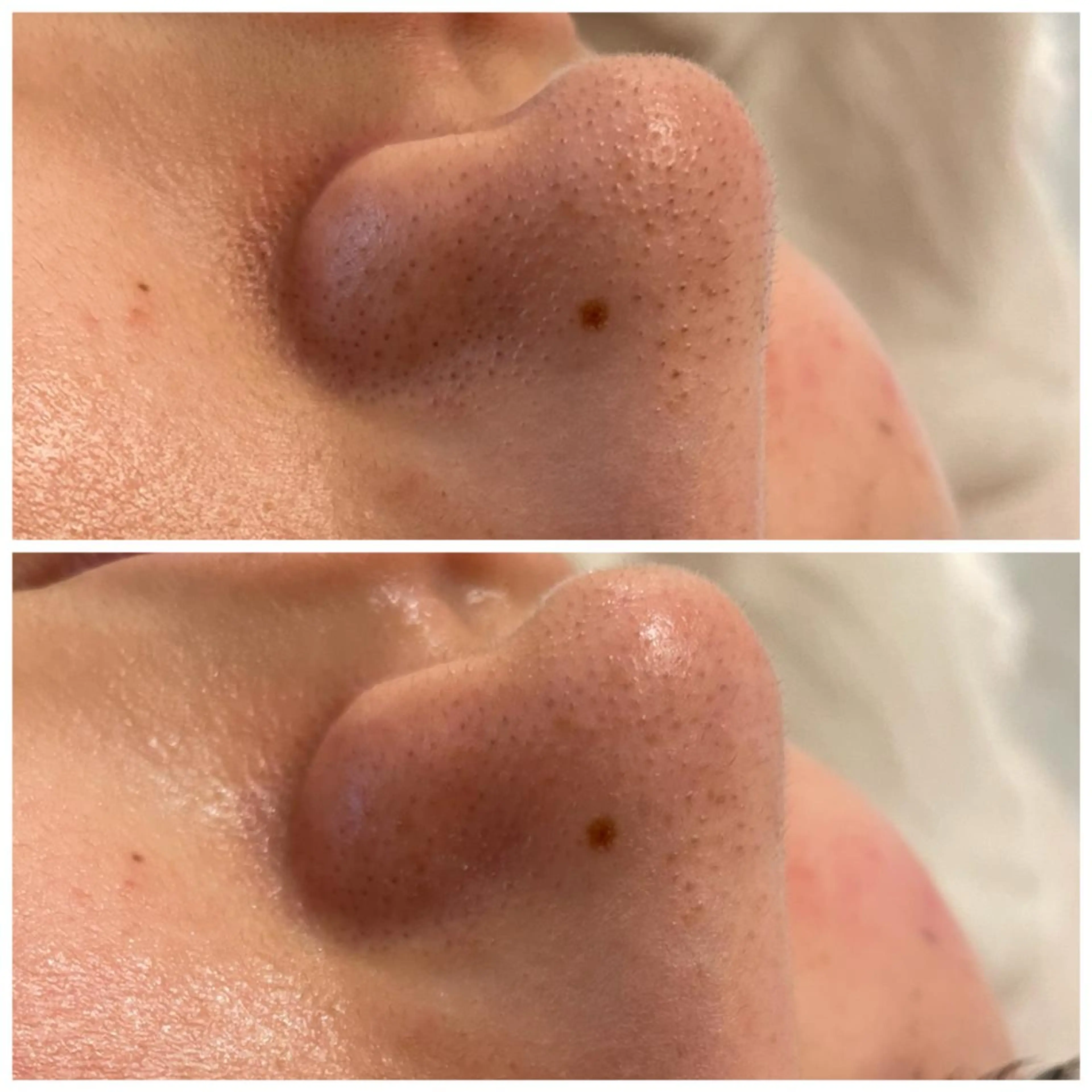 ララ/ハーブ メゾンリュバンのエステ・リラクイメージ