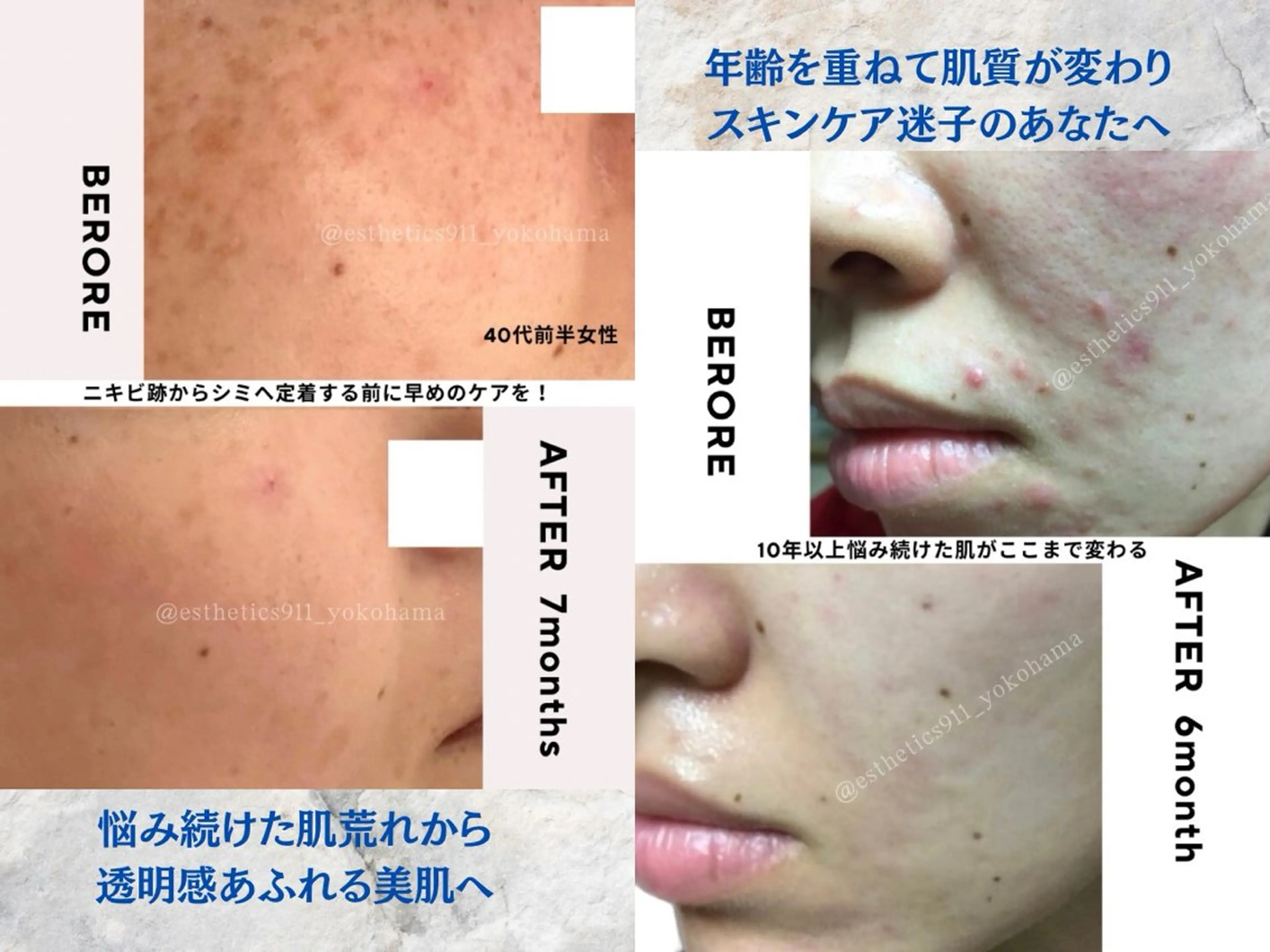 エステ リラク Esthetics 911横浜のエステ・リラクイメージ