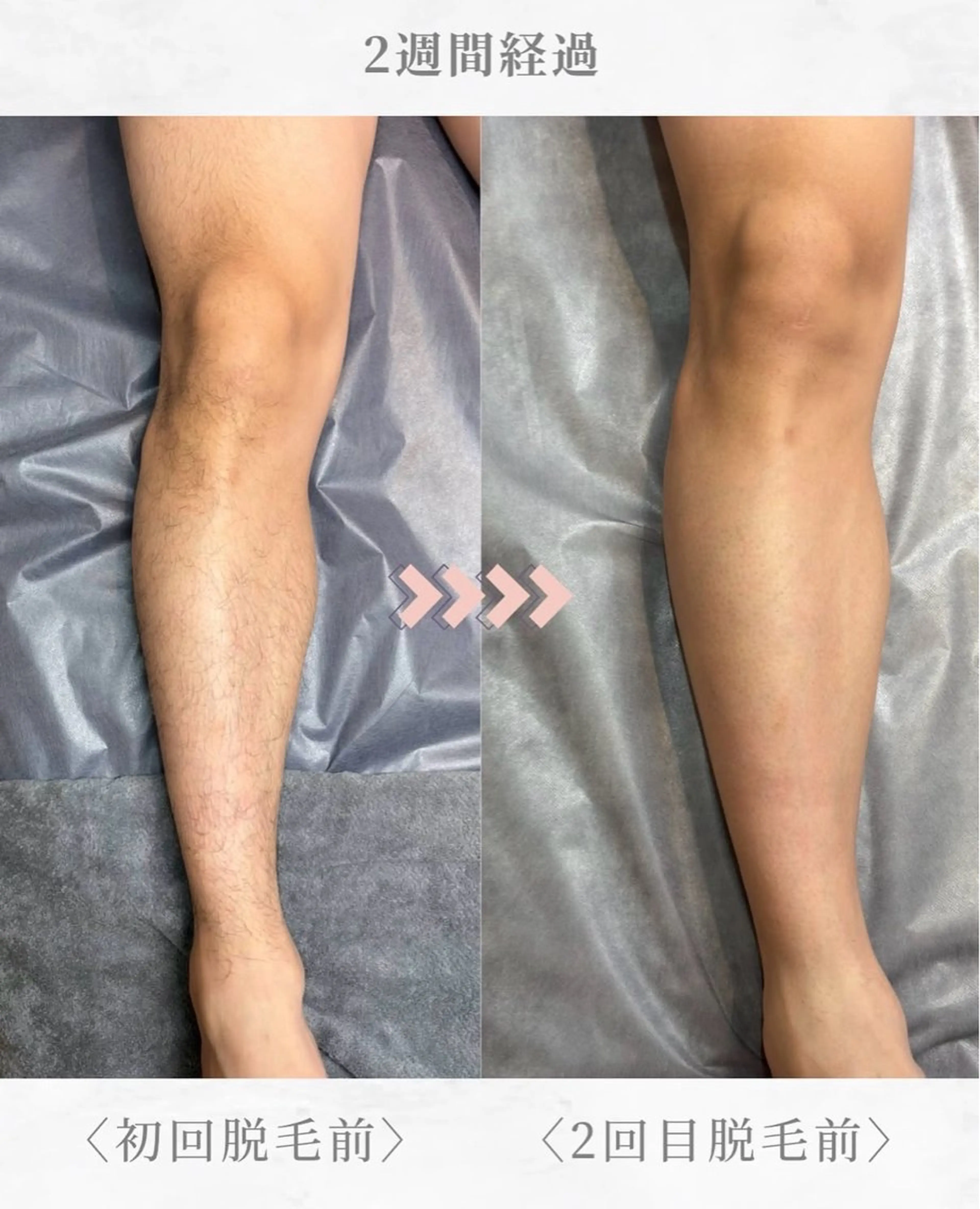 RILsalon 脱毛のエステ・リラクイメージ