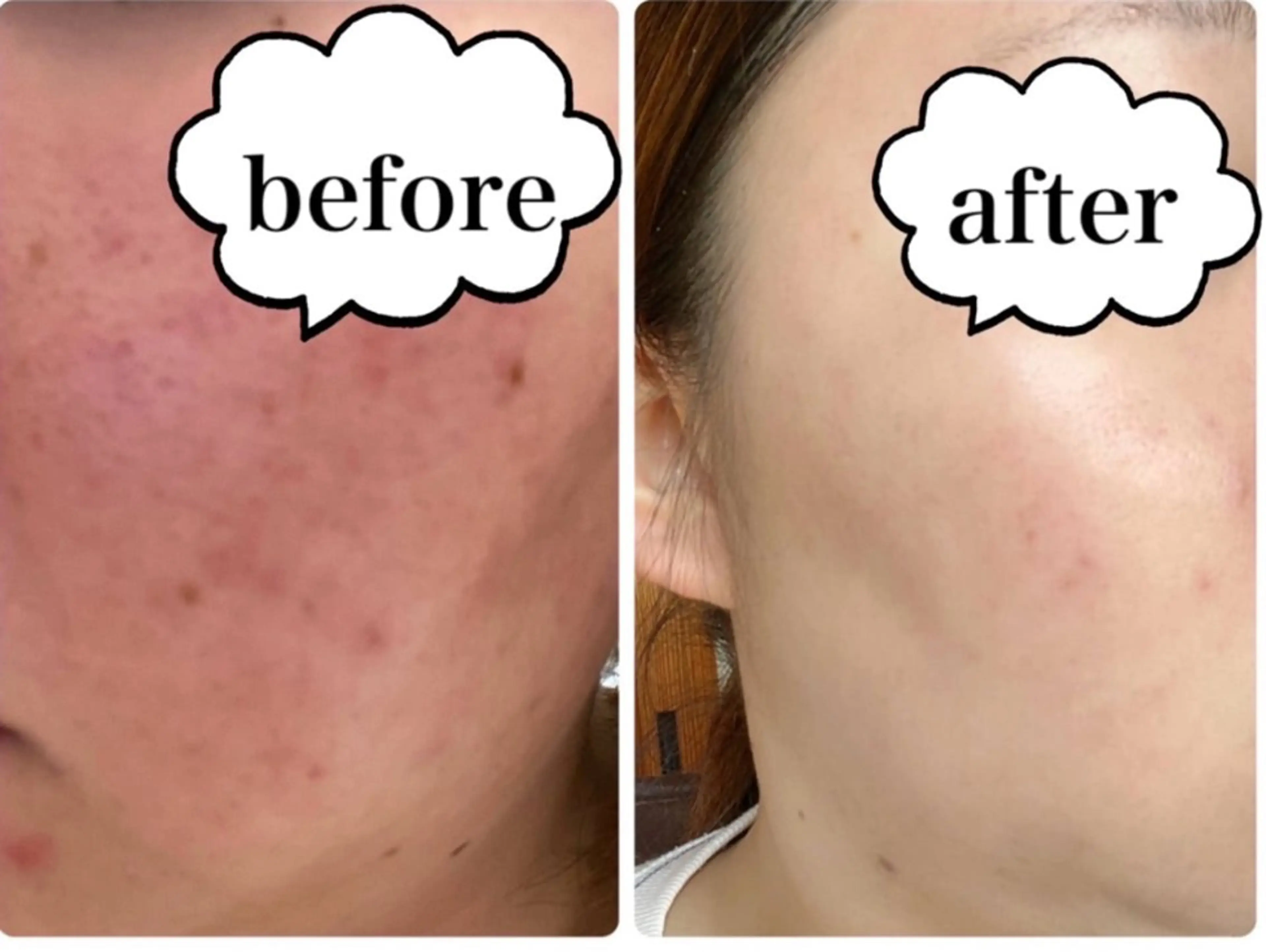 【人気No.1】オーダメイドフルコース🌈ご自身にあった肌別ケアをご提供🌱の写真