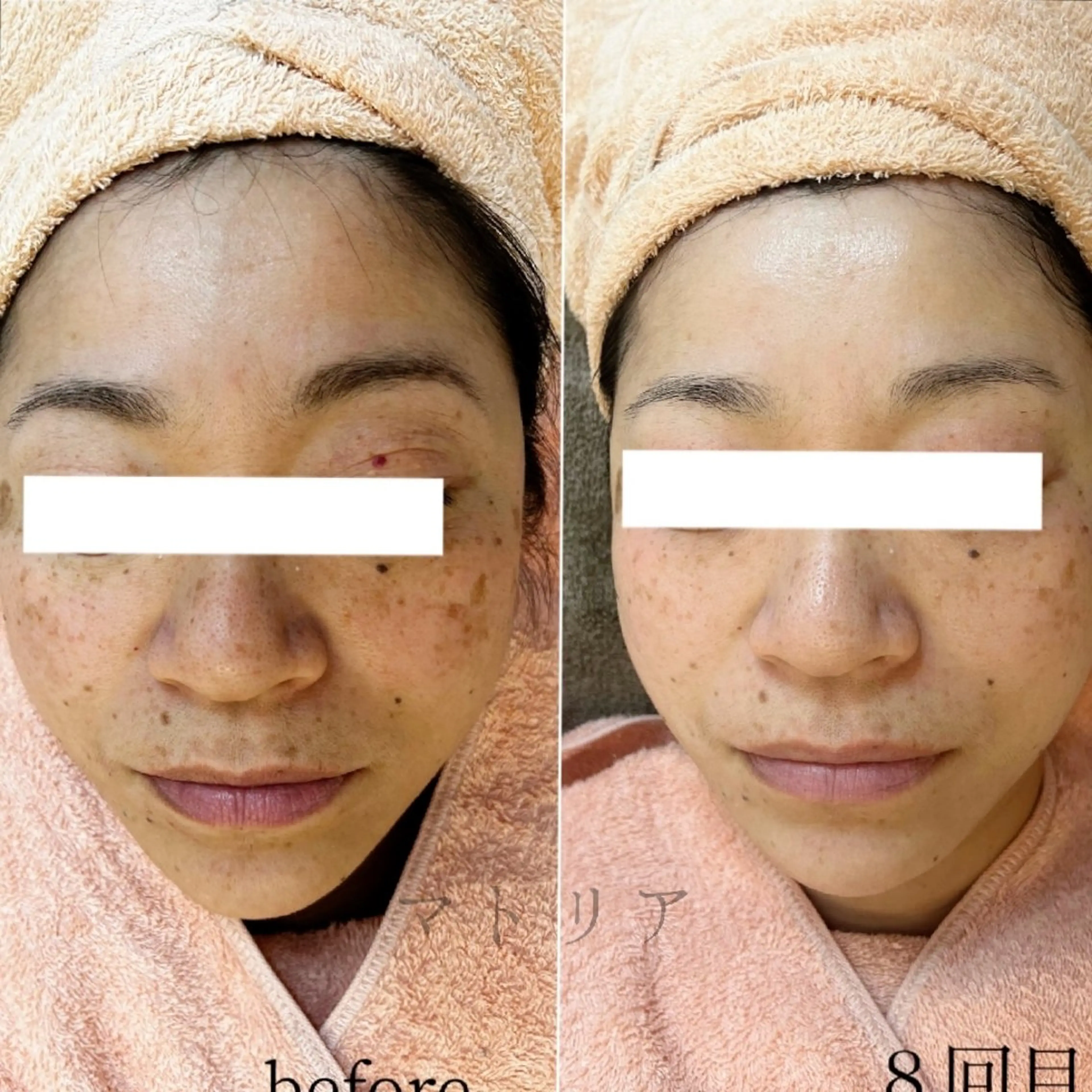 土台美容！年齢肌による、お悩みにアプローチの写真