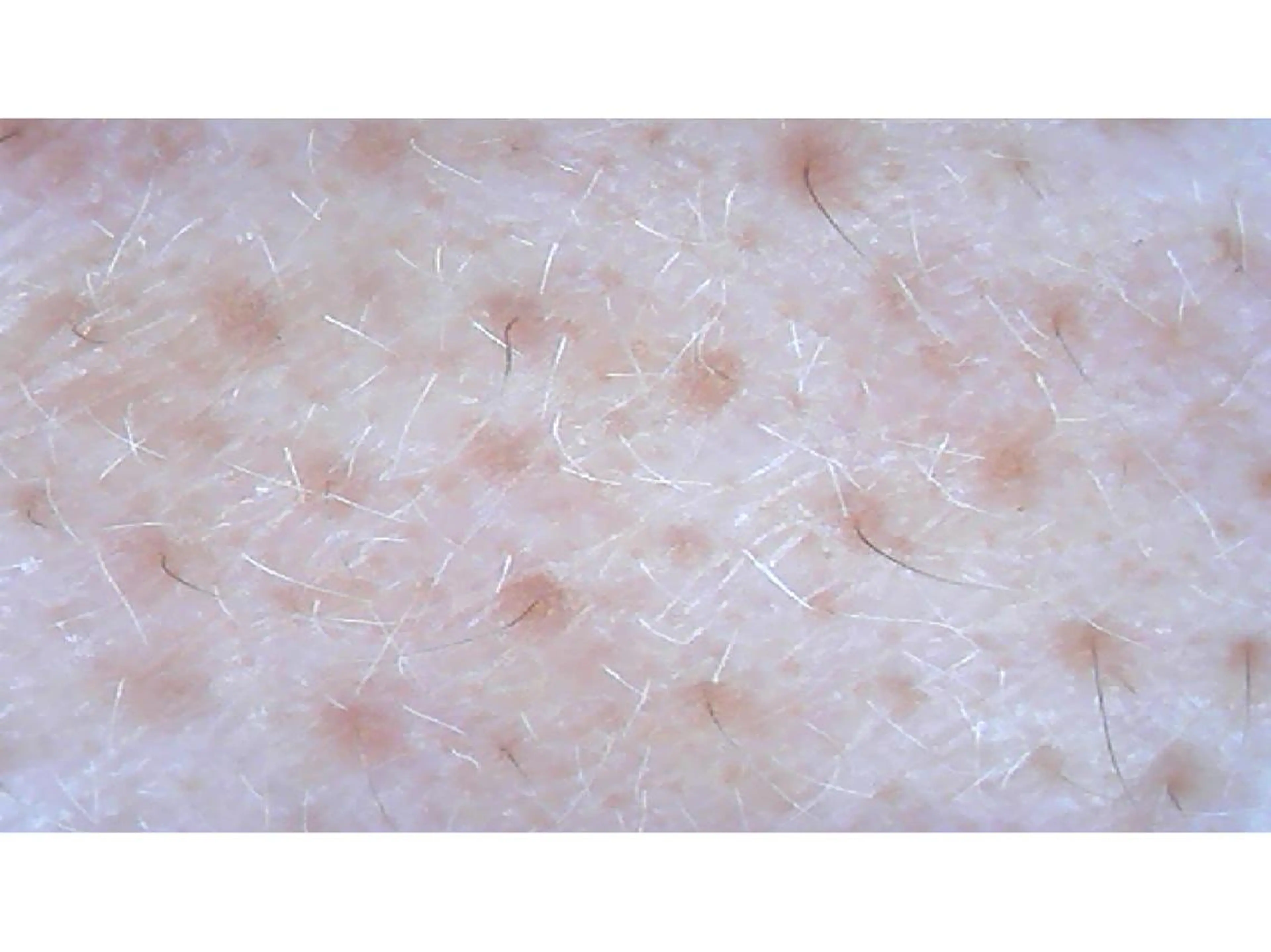 エステ リラク 宮野 麻綺のエステ・リラクイメージ