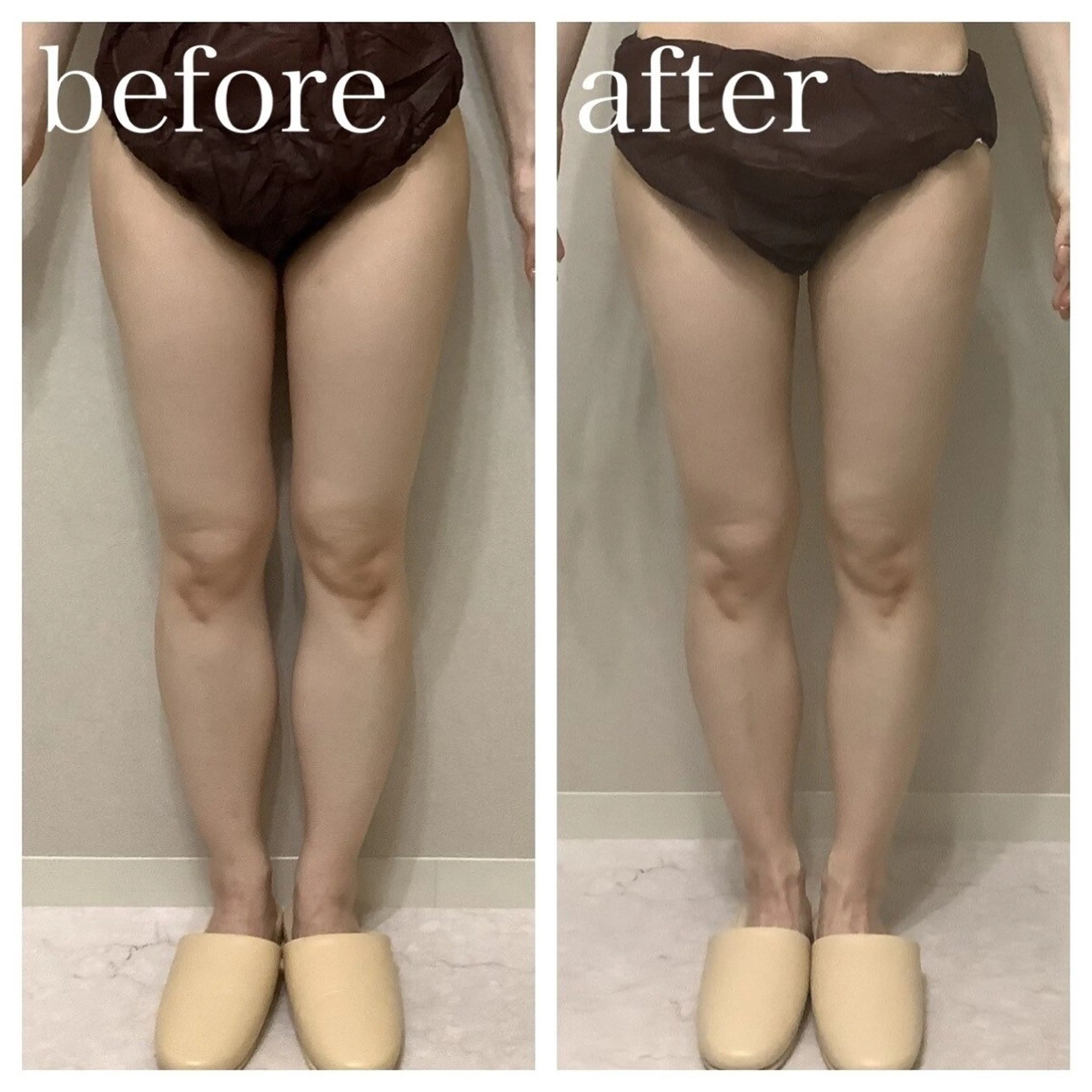 エステ aimer 佐々木のエステ・リラクイメージ