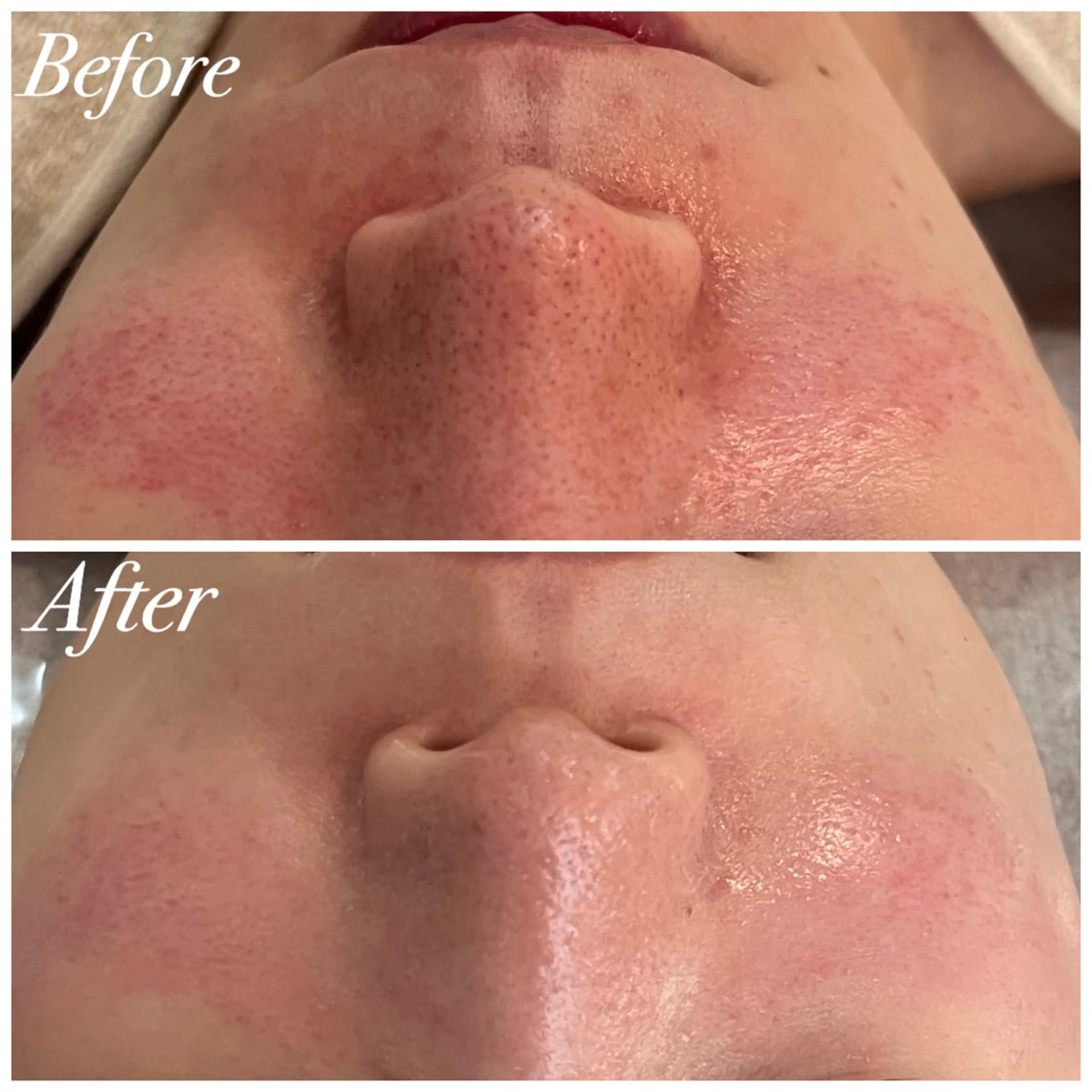 エステ リラク Plaran 〜プララン 〜のその他イメージ