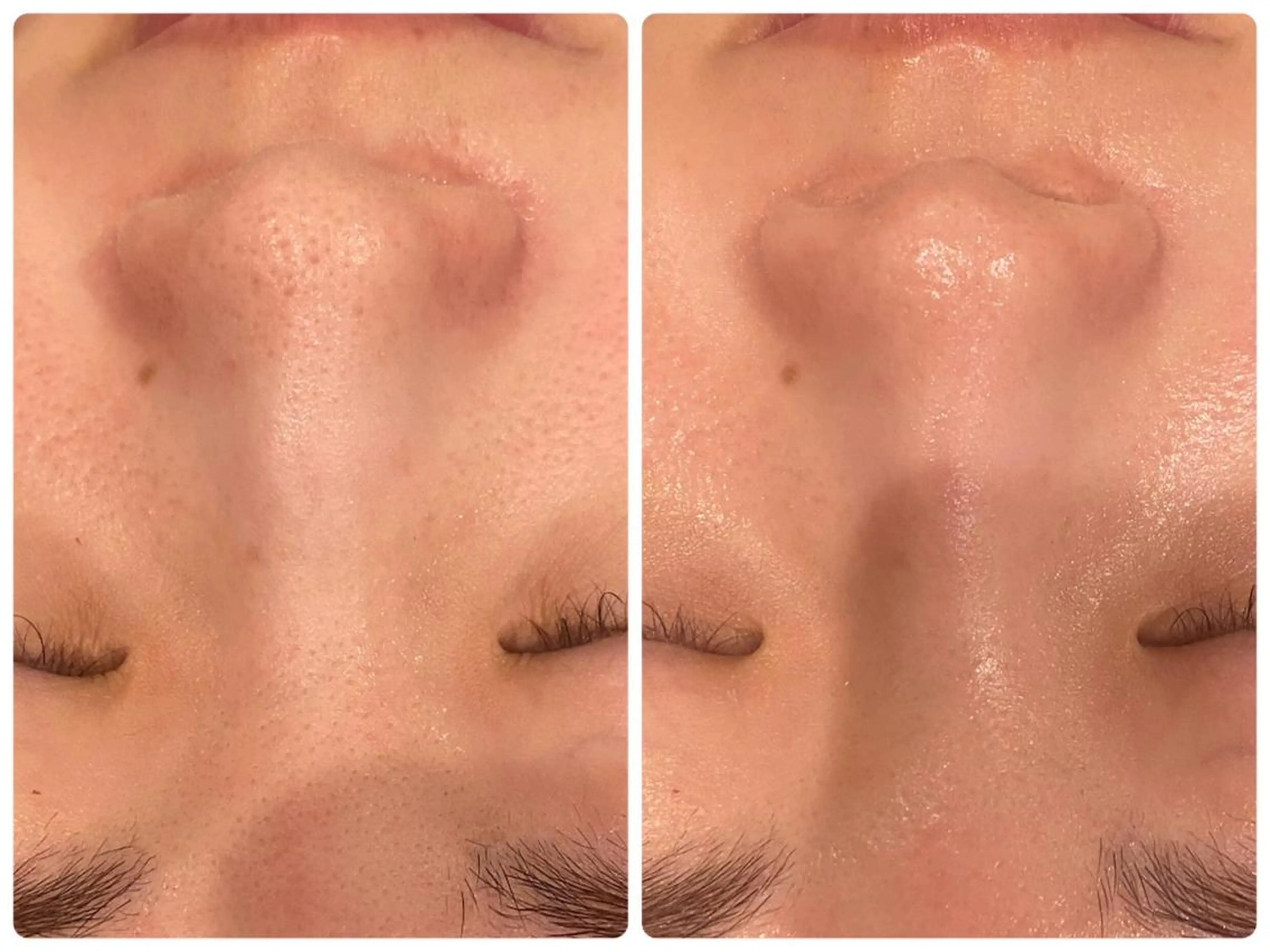 レイビス名古屋♡ 伊波のエステ・リラクイメージ