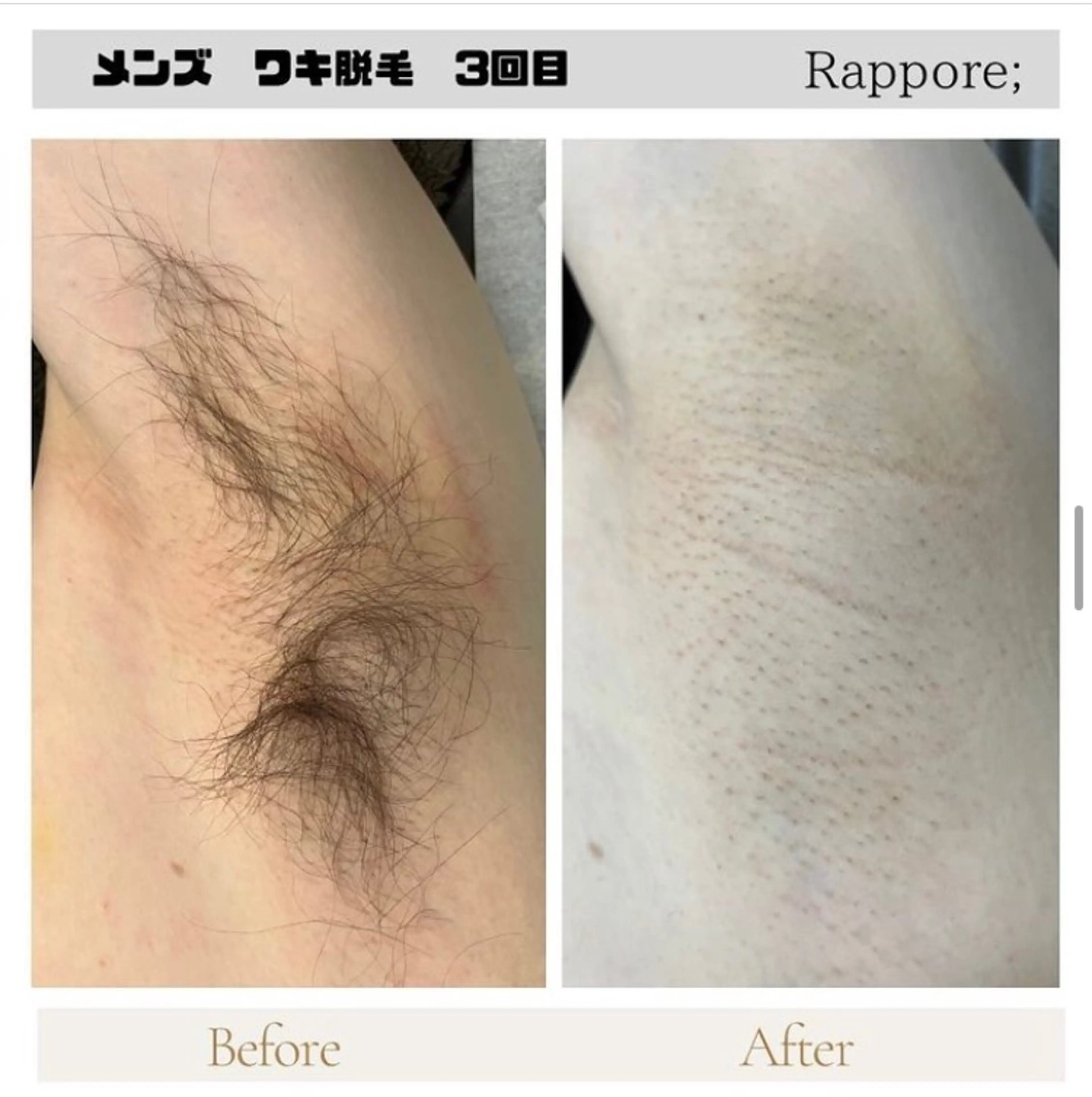 メンズ 脱毛＆フェイシャル/ Rappore;増田のエステ・リラクイメージ