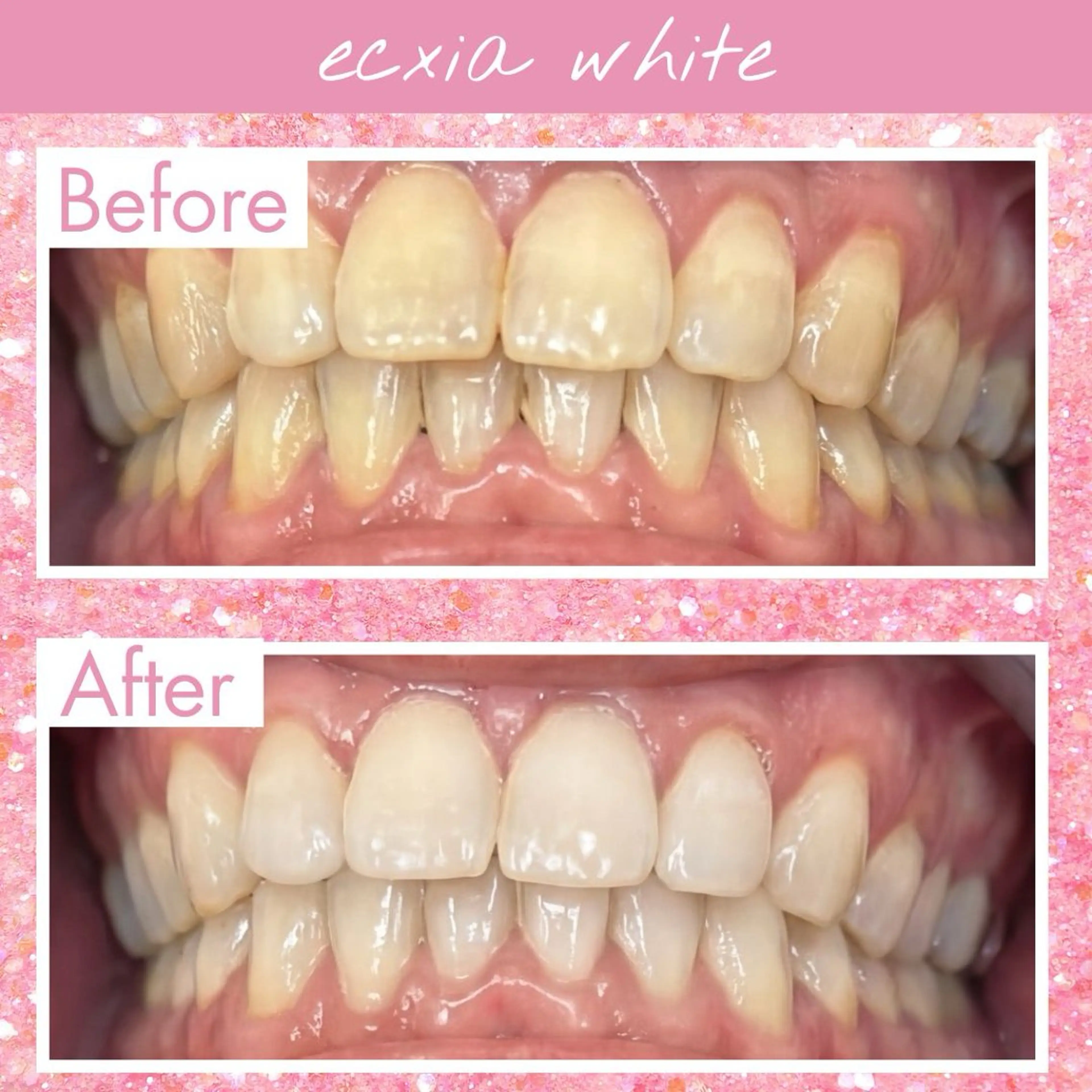 セルフホワイトニング エクシア戸田公園店のその他イメージ