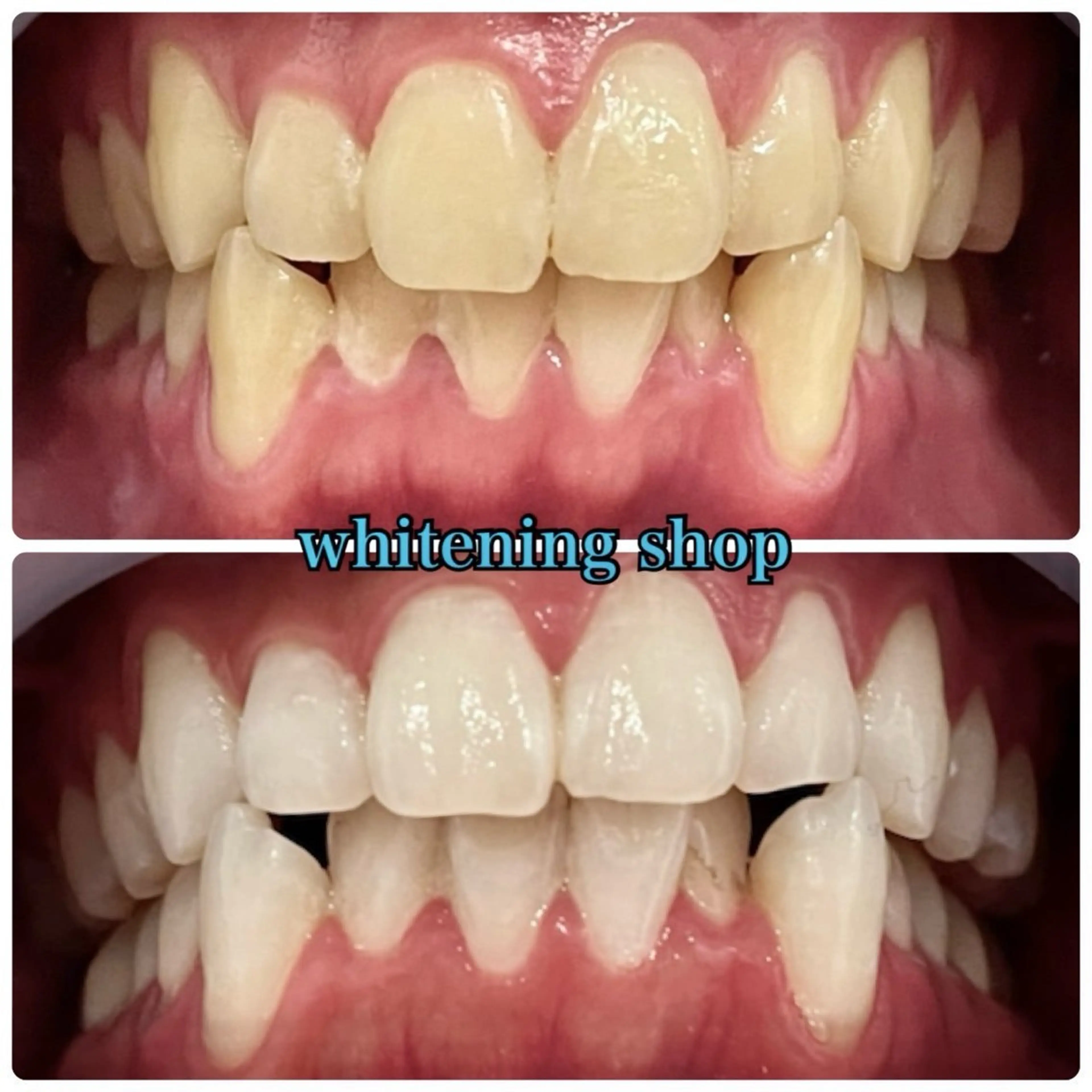 メンズ エステ リラク ホワイトニング ショップ川越店のエステ・リラクイメージ