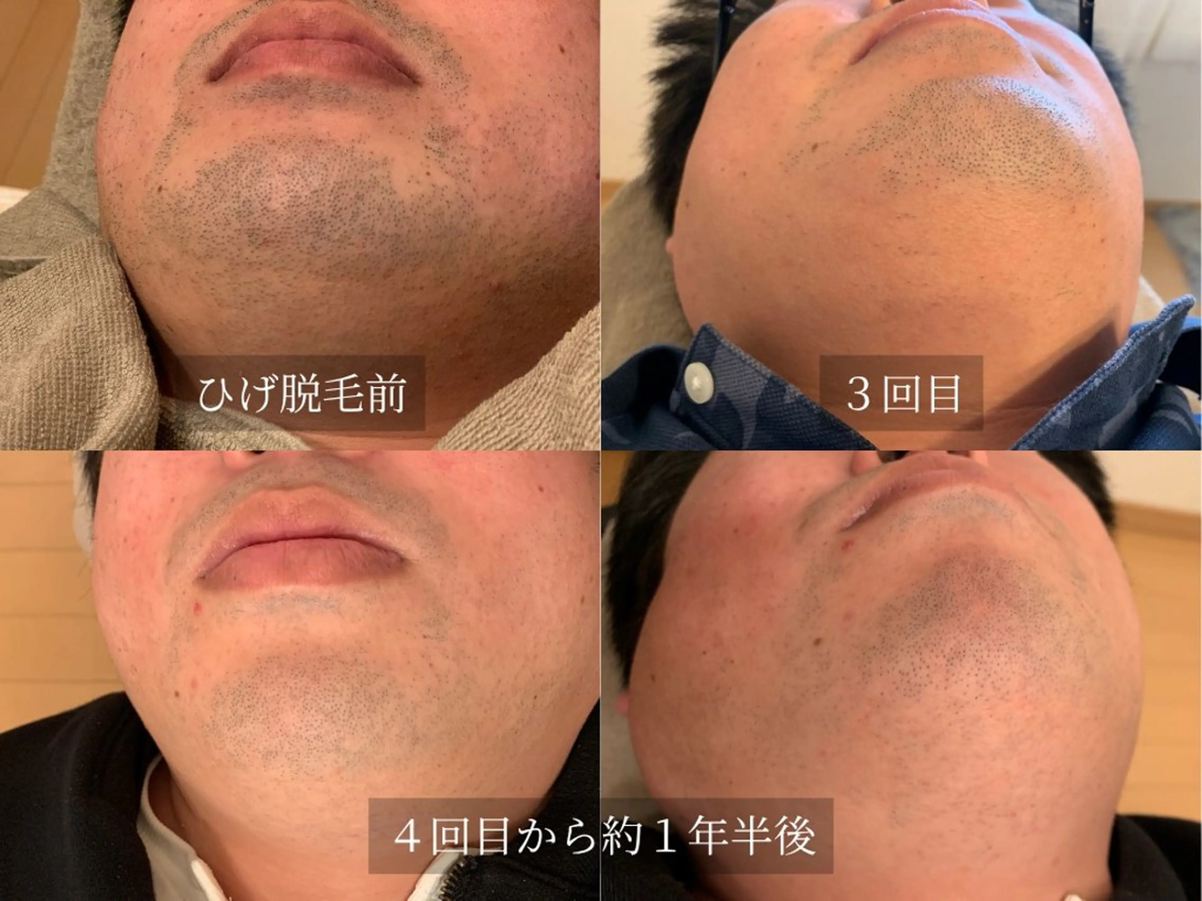 脱毛サロン Arumのエステ・リラクイメージ