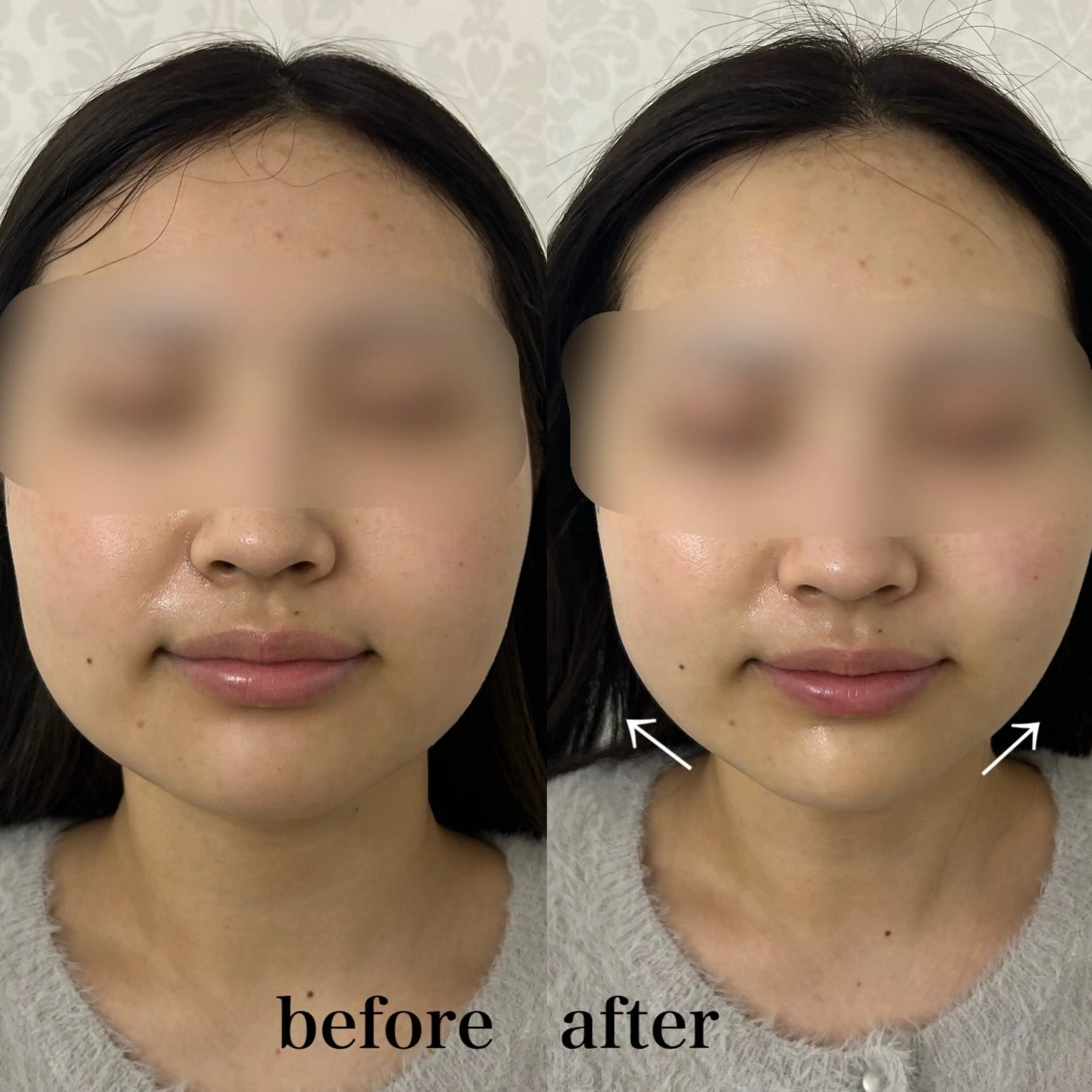 エステ フェイシャルサロン CHIARA 荒田のエステ・リラクイメージ