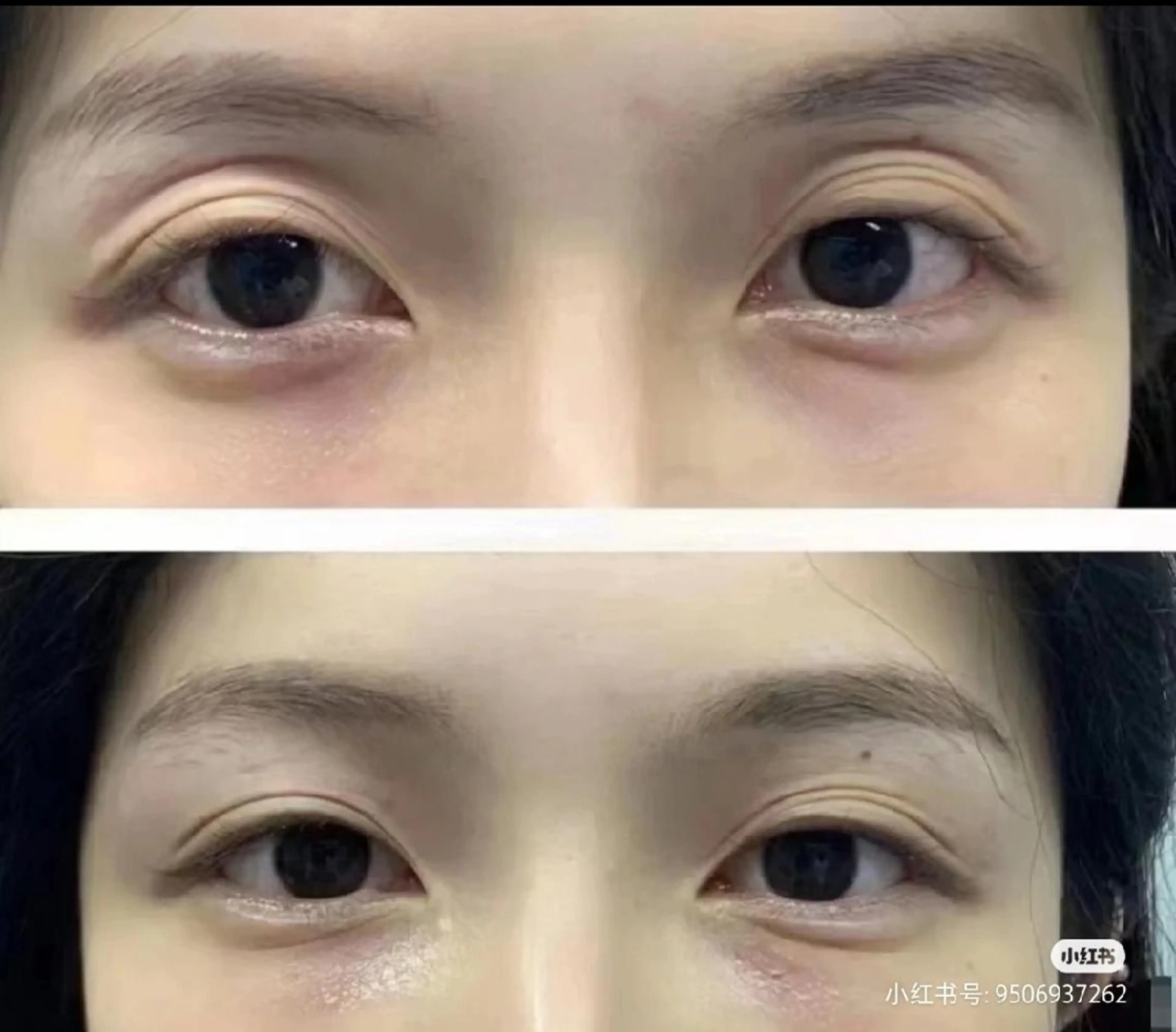 エステ aliaハーブ水光店 エステティシャン募集のエステ・リラクイメージ