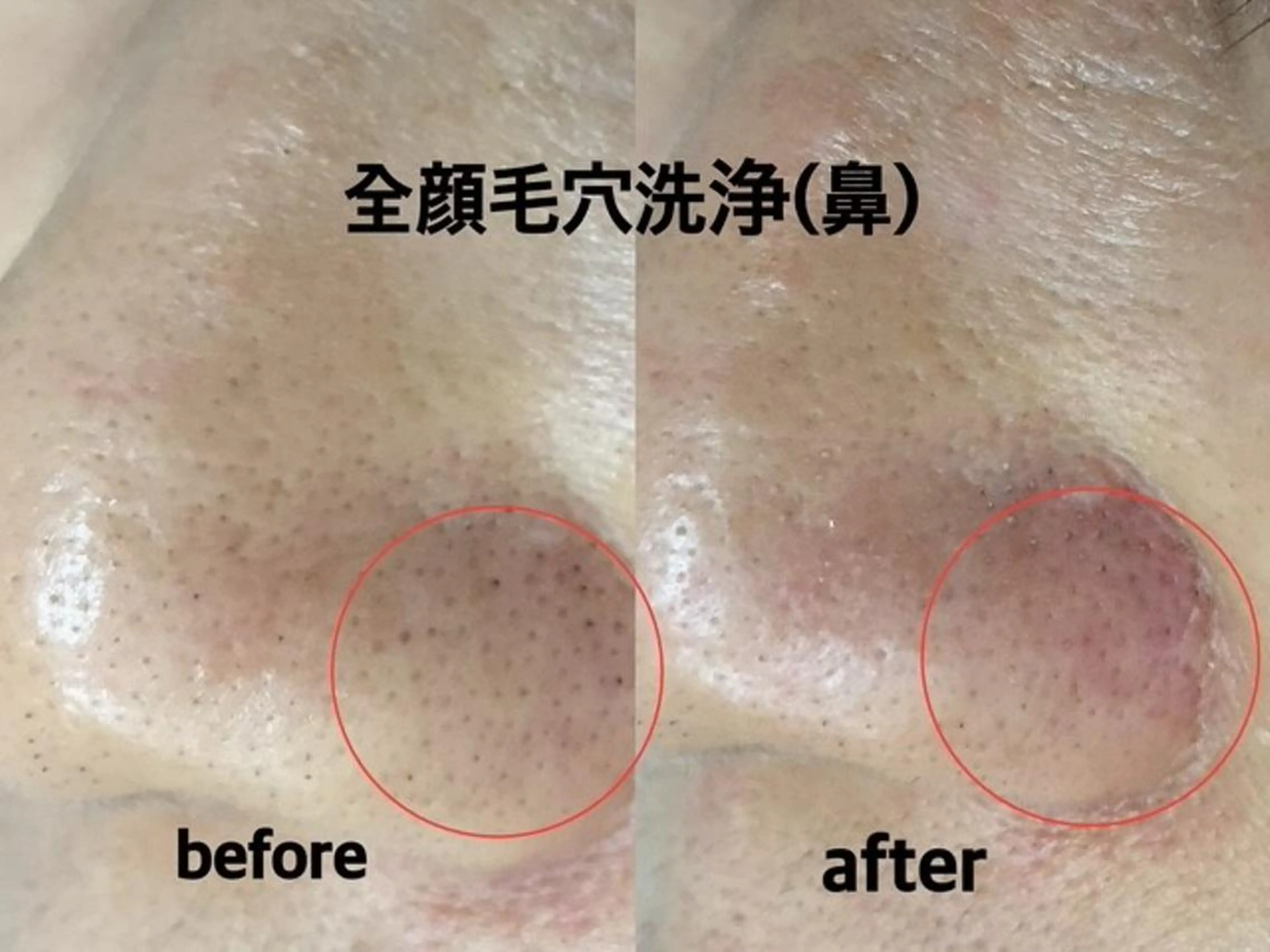 肌ケア＆毛穴洗浄 Cheri/女性専用のエステ・リラクイメージ