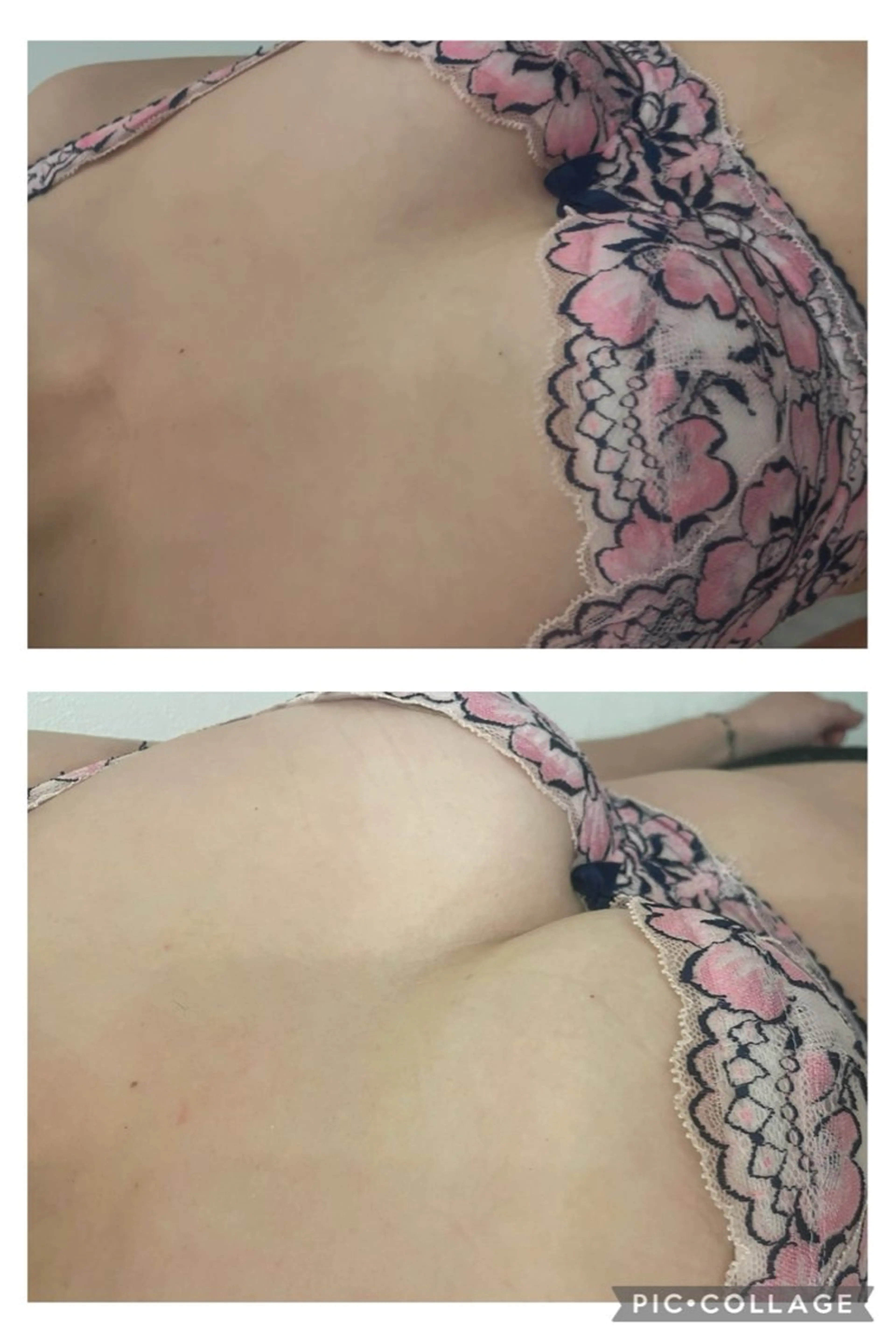 ふっくらバスト&二の腕ケアの写真