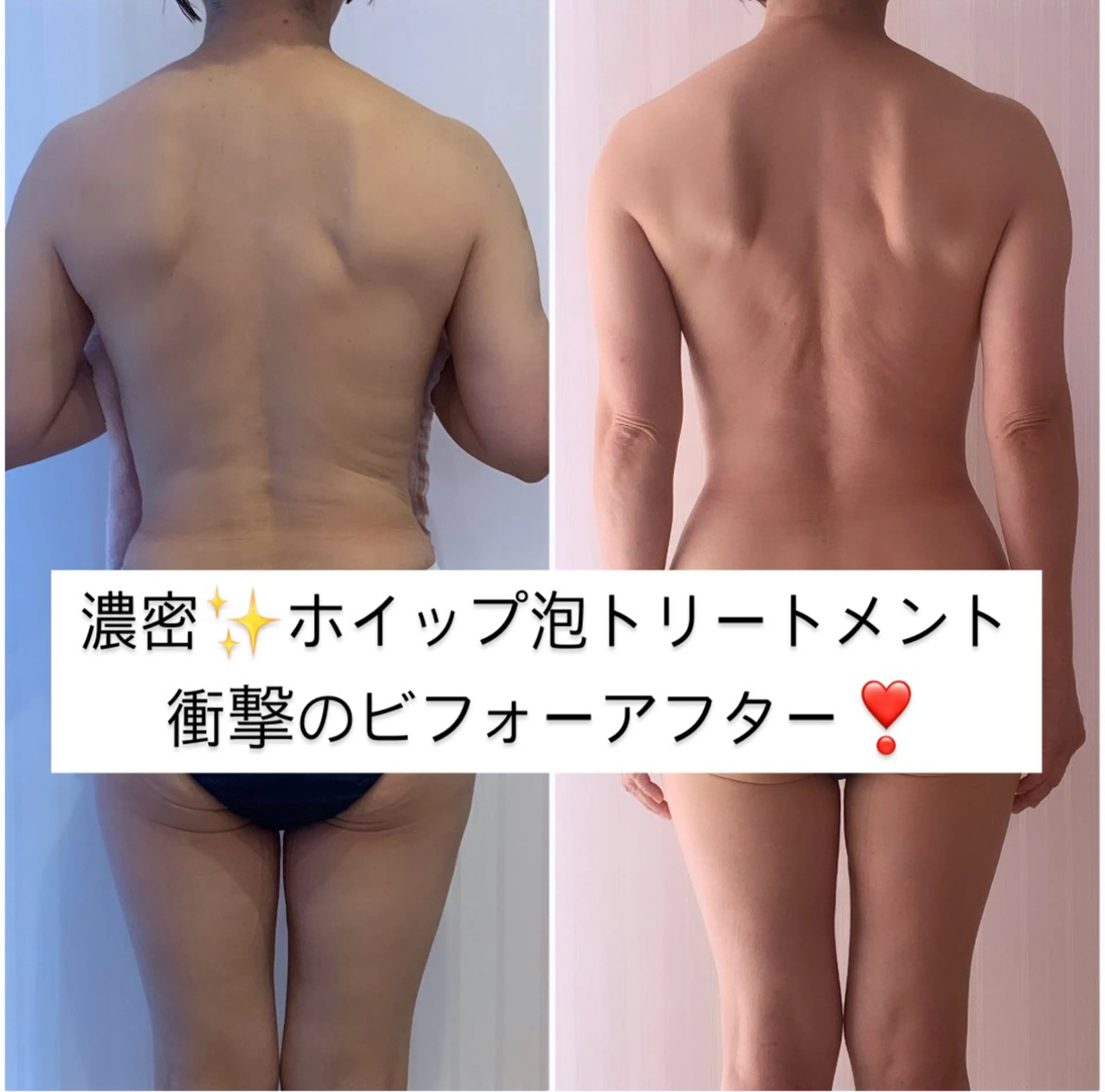 美乳強化サロン LOVEMYSELFのその他イメージ