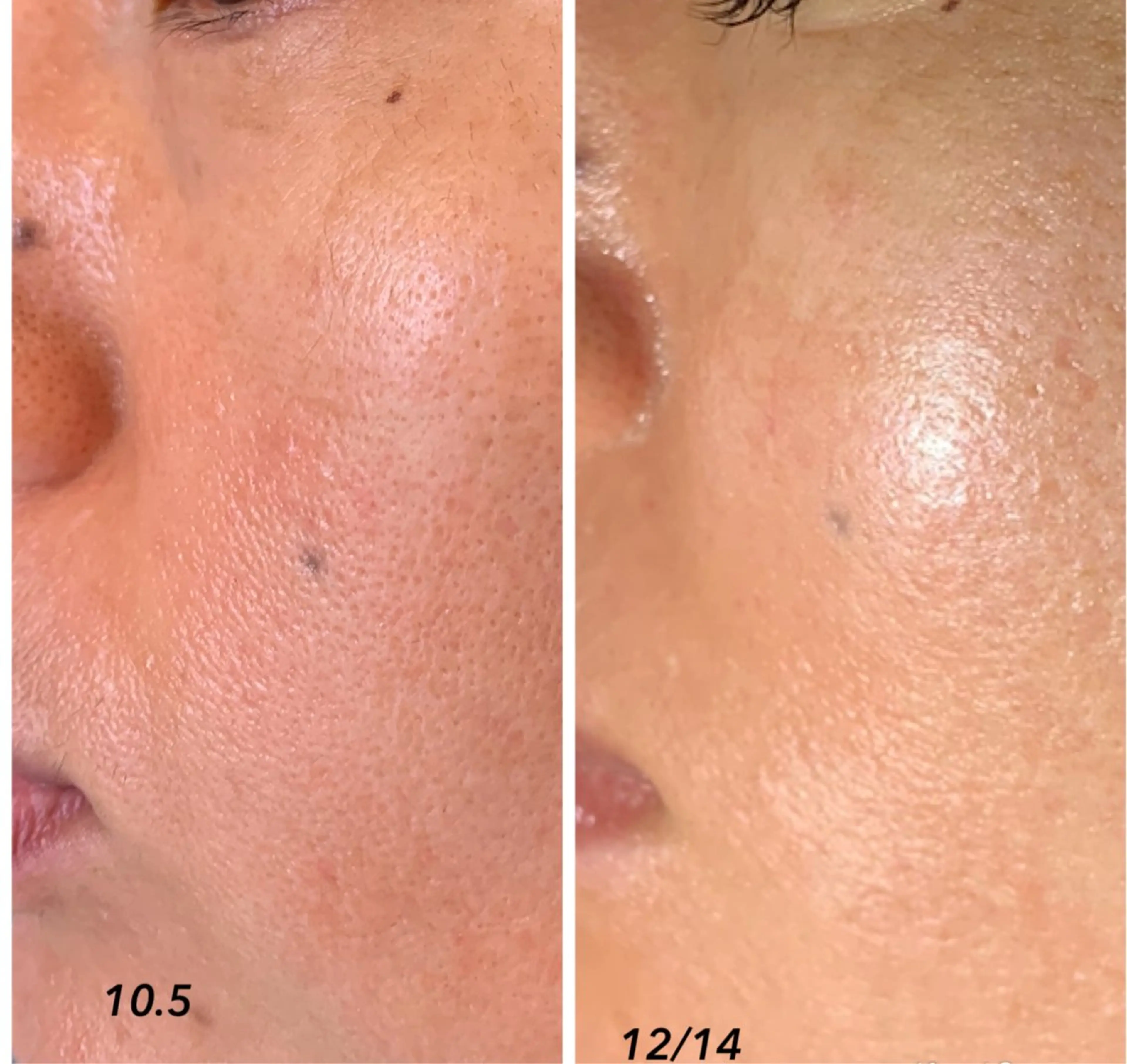 フェイシャルワックス 自然派エステファーノのその他イメージ