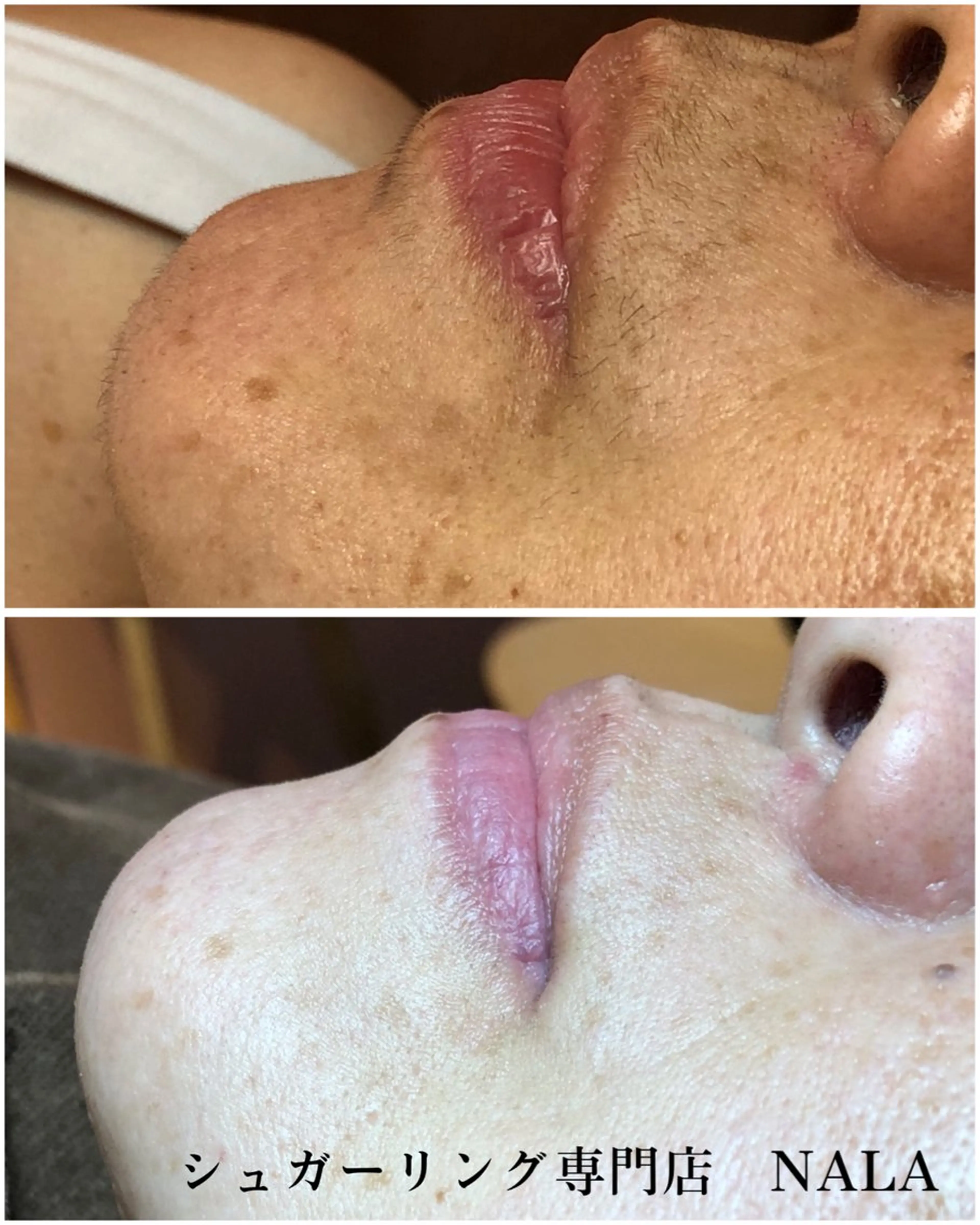 ブラジリアンシュガーリング専門店NALA所属・シュガーリング 専門店『NALA』のエステ・リラクイメージ
