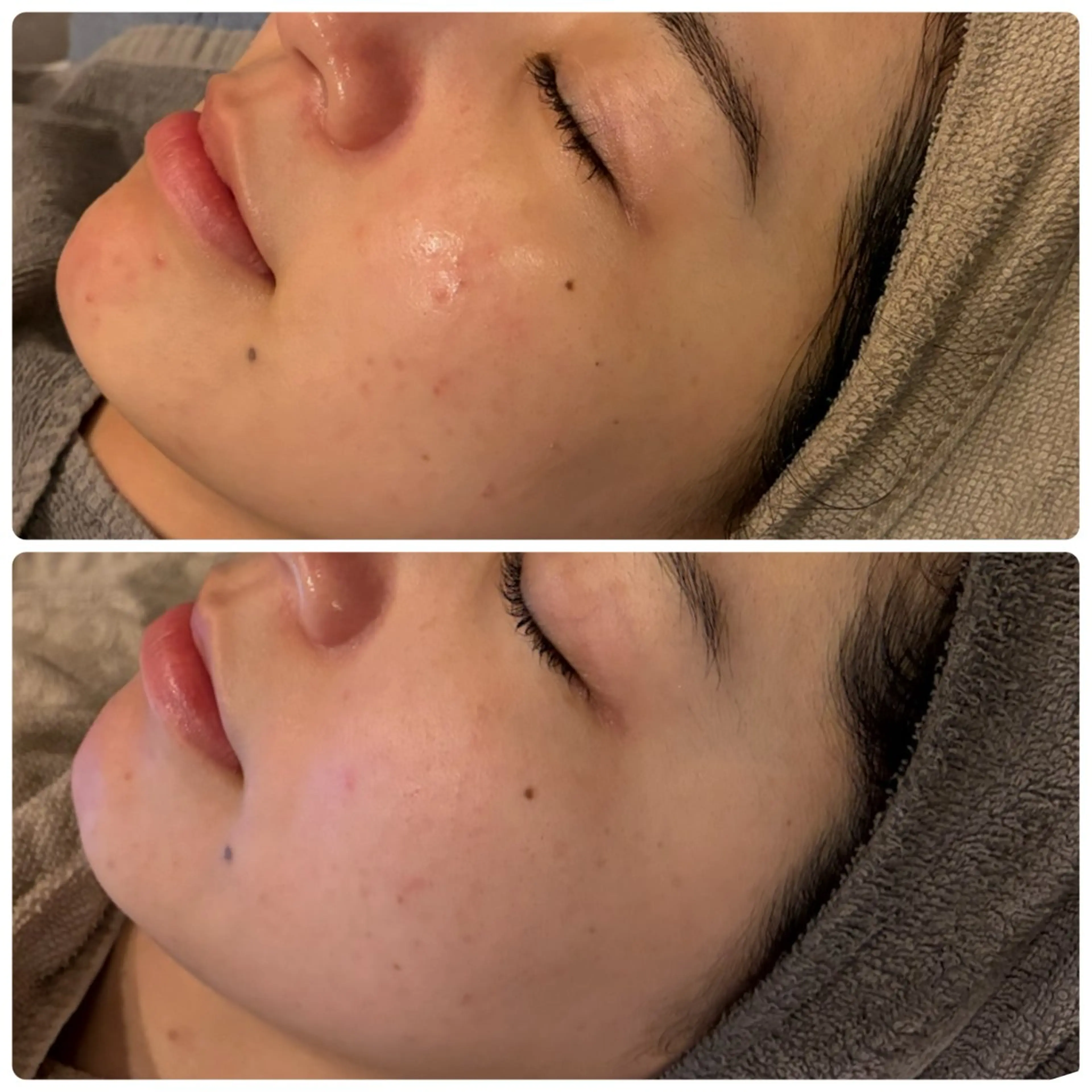 脱毛 yellow💛【 脱毛&フェイシャル】のエステ・リラクイメージ