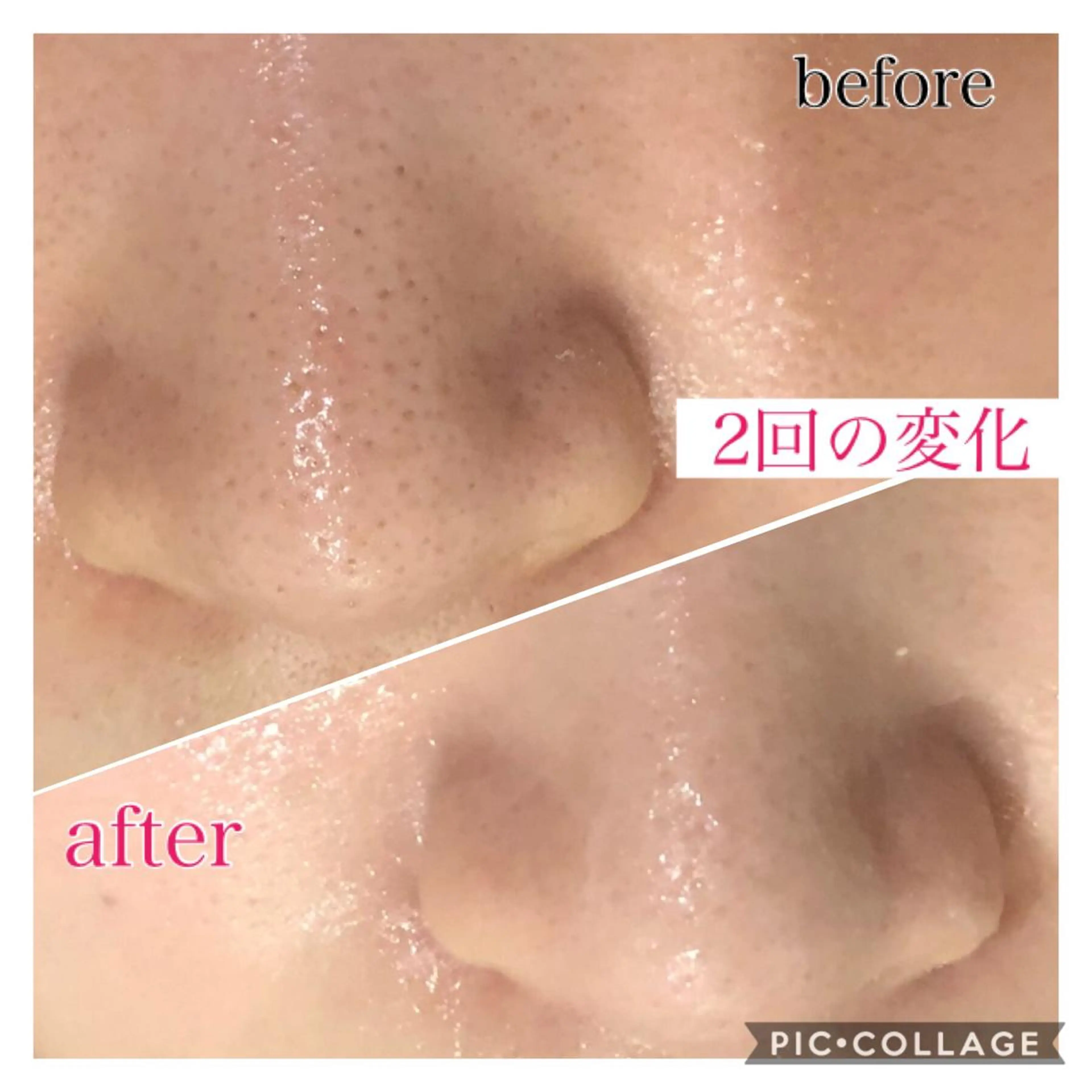 ミディアム カラー パーマ ヘアアレンジ キッズ ネイル マツエク・マツパ エステ リラク EnsorClair 代表 野口真央のエステ・リラクイメージ
