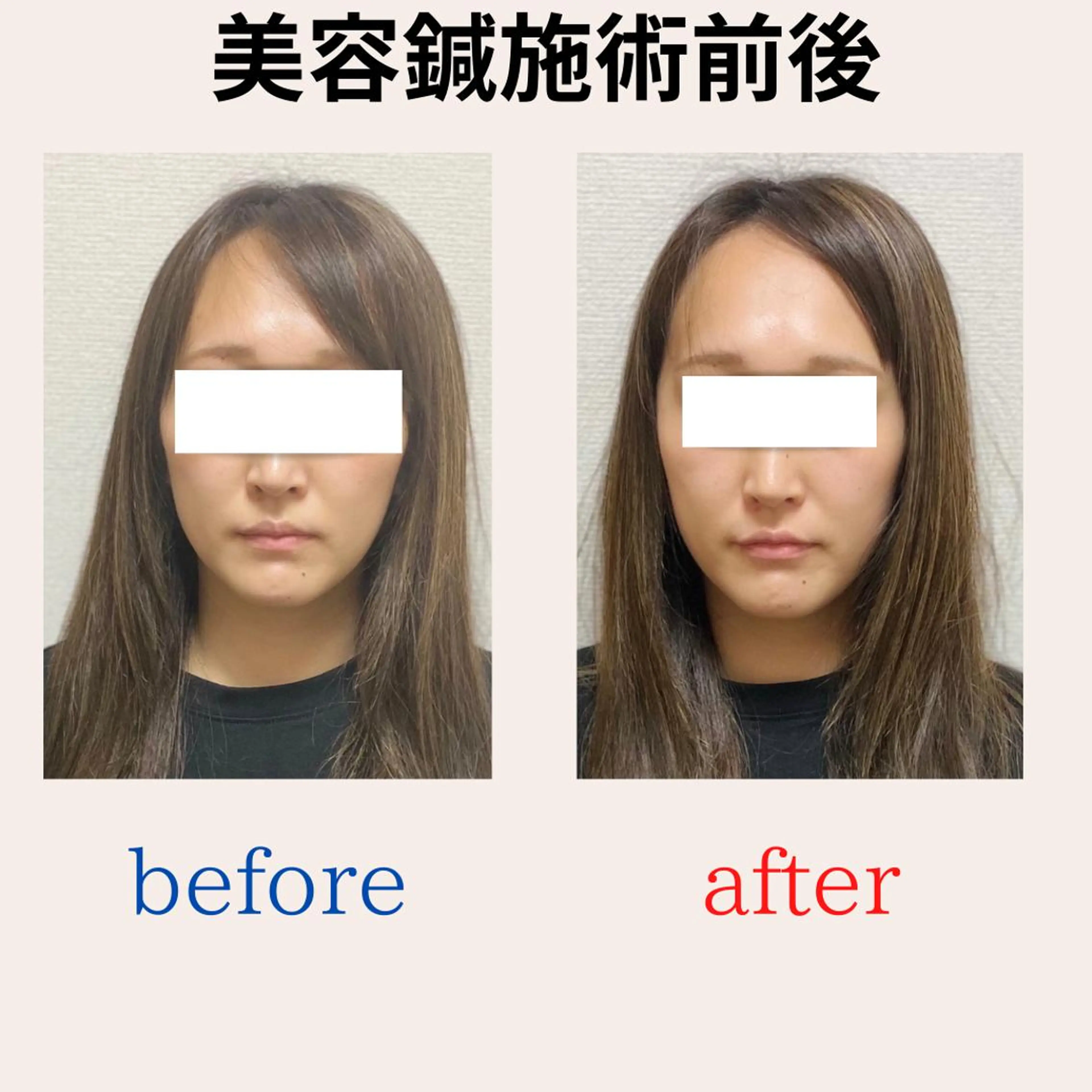 BEAUTY&HEALTH鍼灸院【春日部筋膜整体タケダ整体院】所属・武田 紘輝のエステ・リラクイメージ