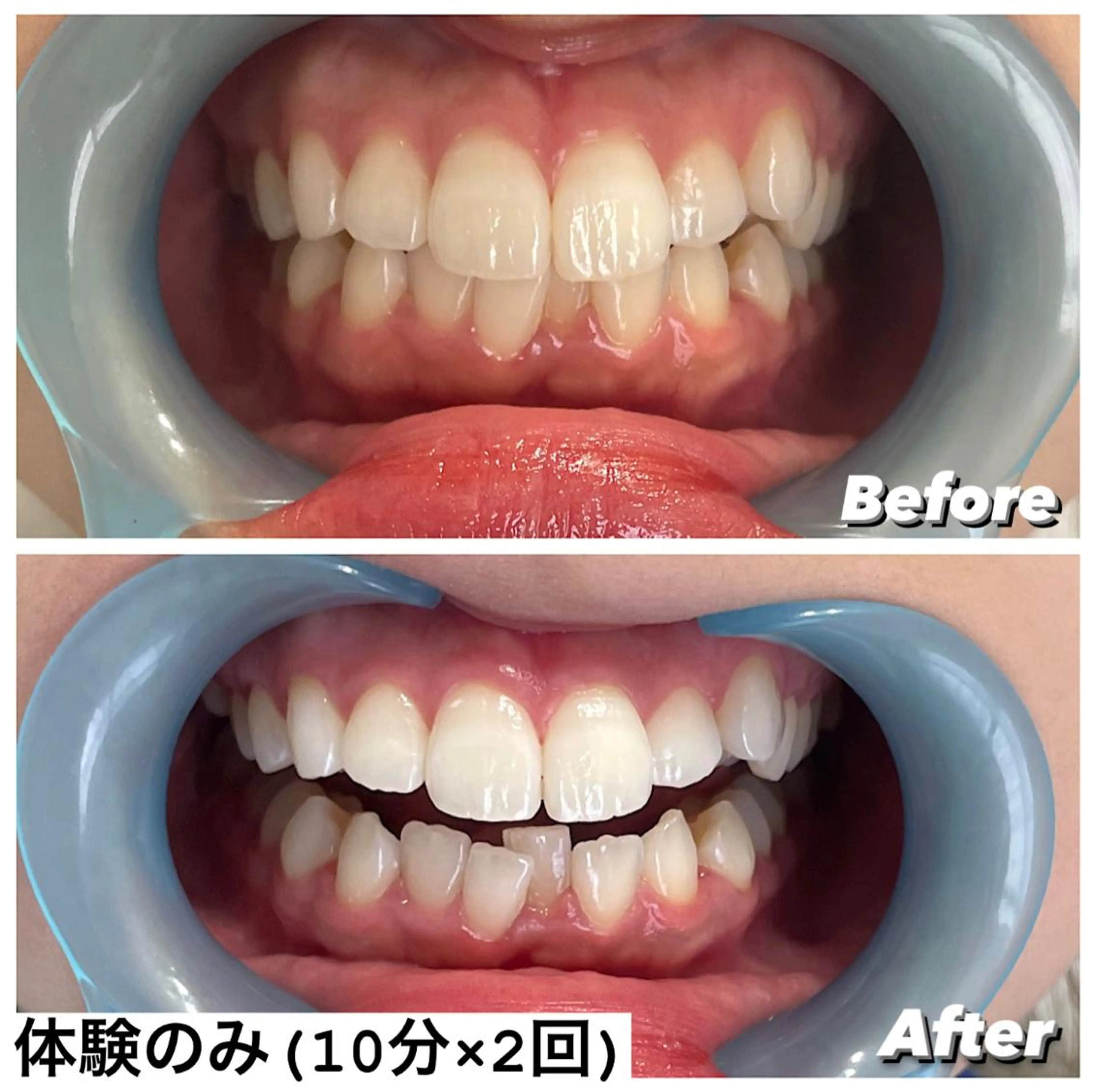 ホワイトニング専門店 Hi-Whiteのその他イメージ