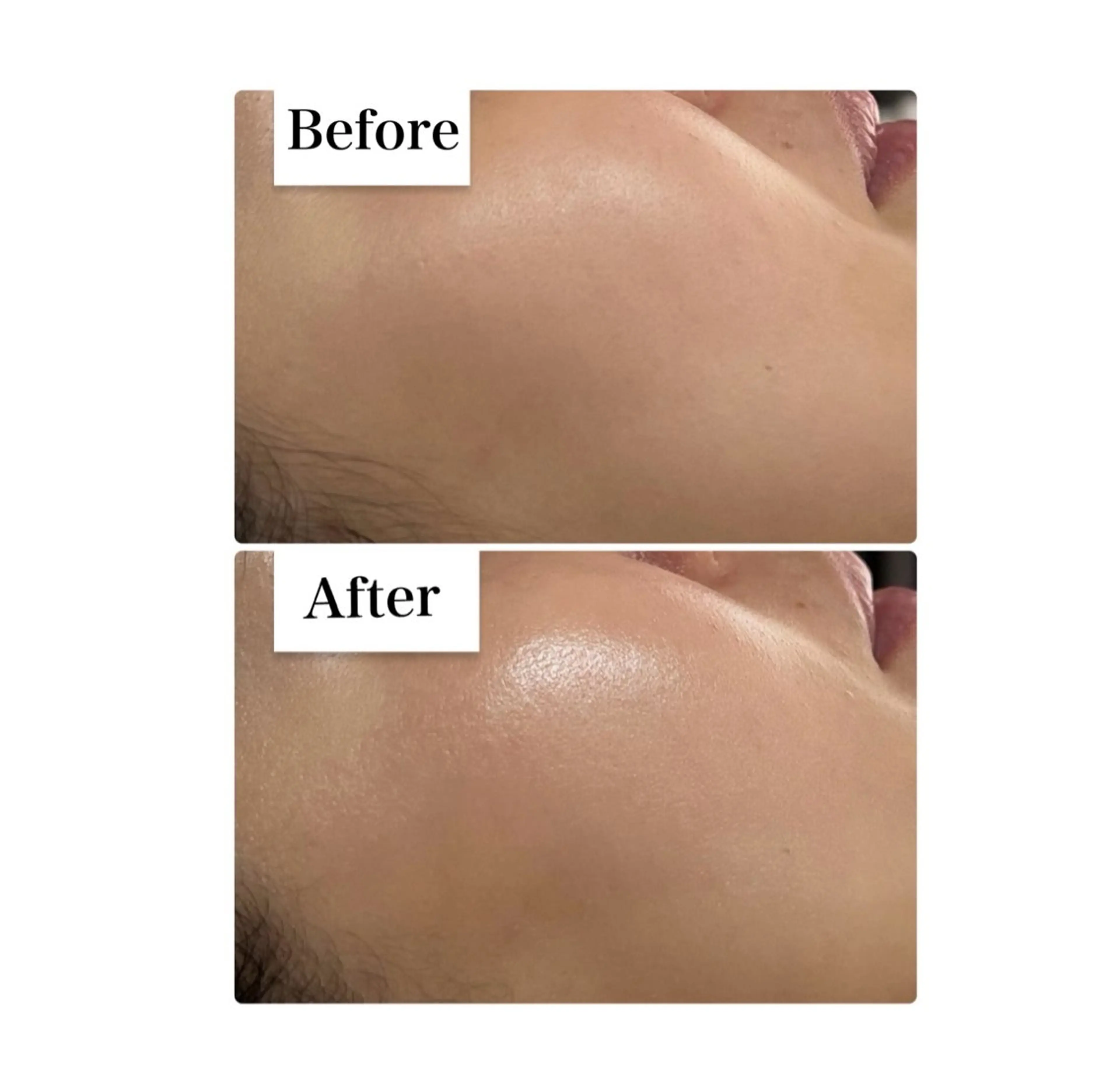 エステ ROR Akariのエステ・リラクイメージ