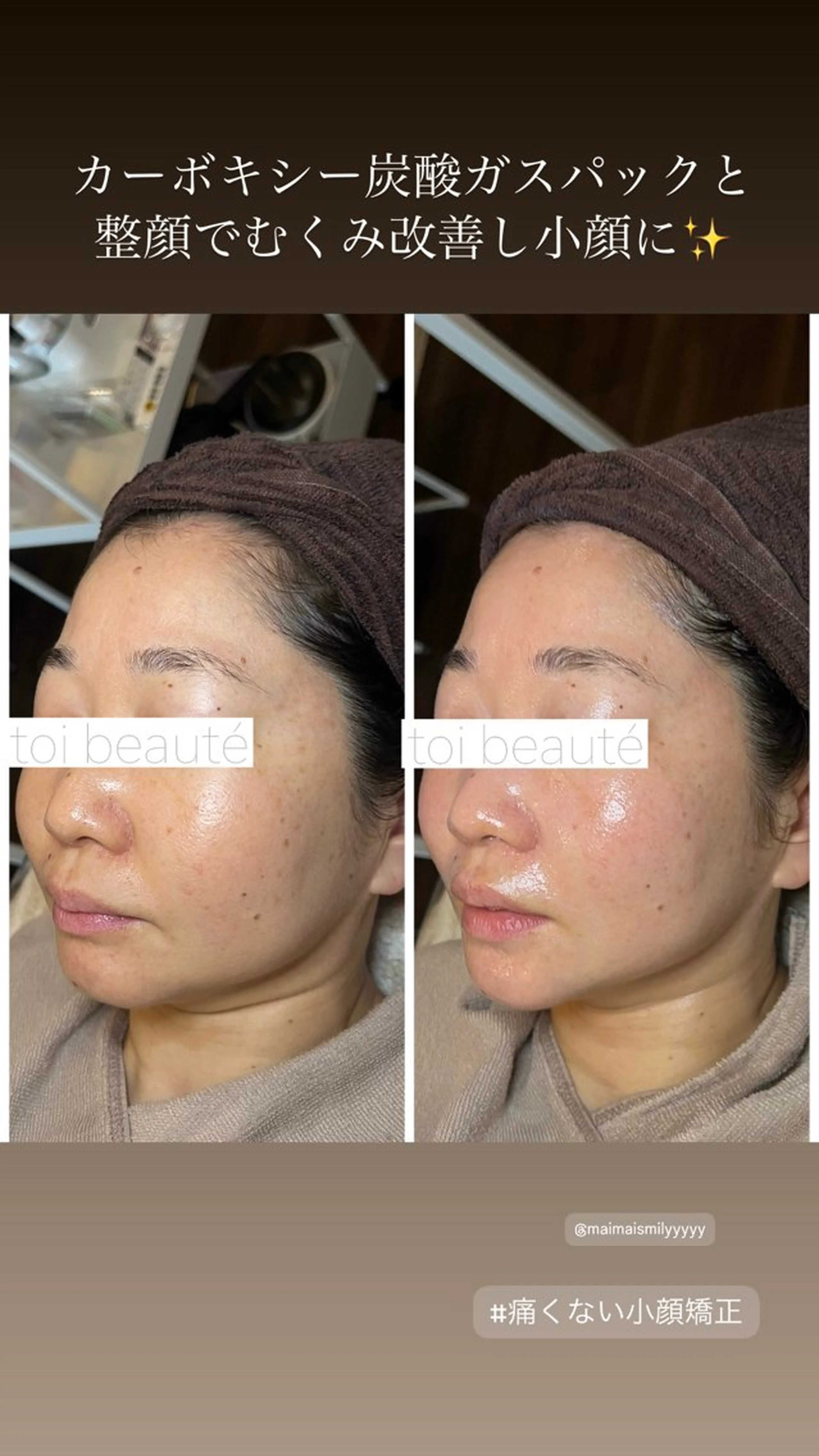 柳瀬 絵美のマツエク・マツパデザイン