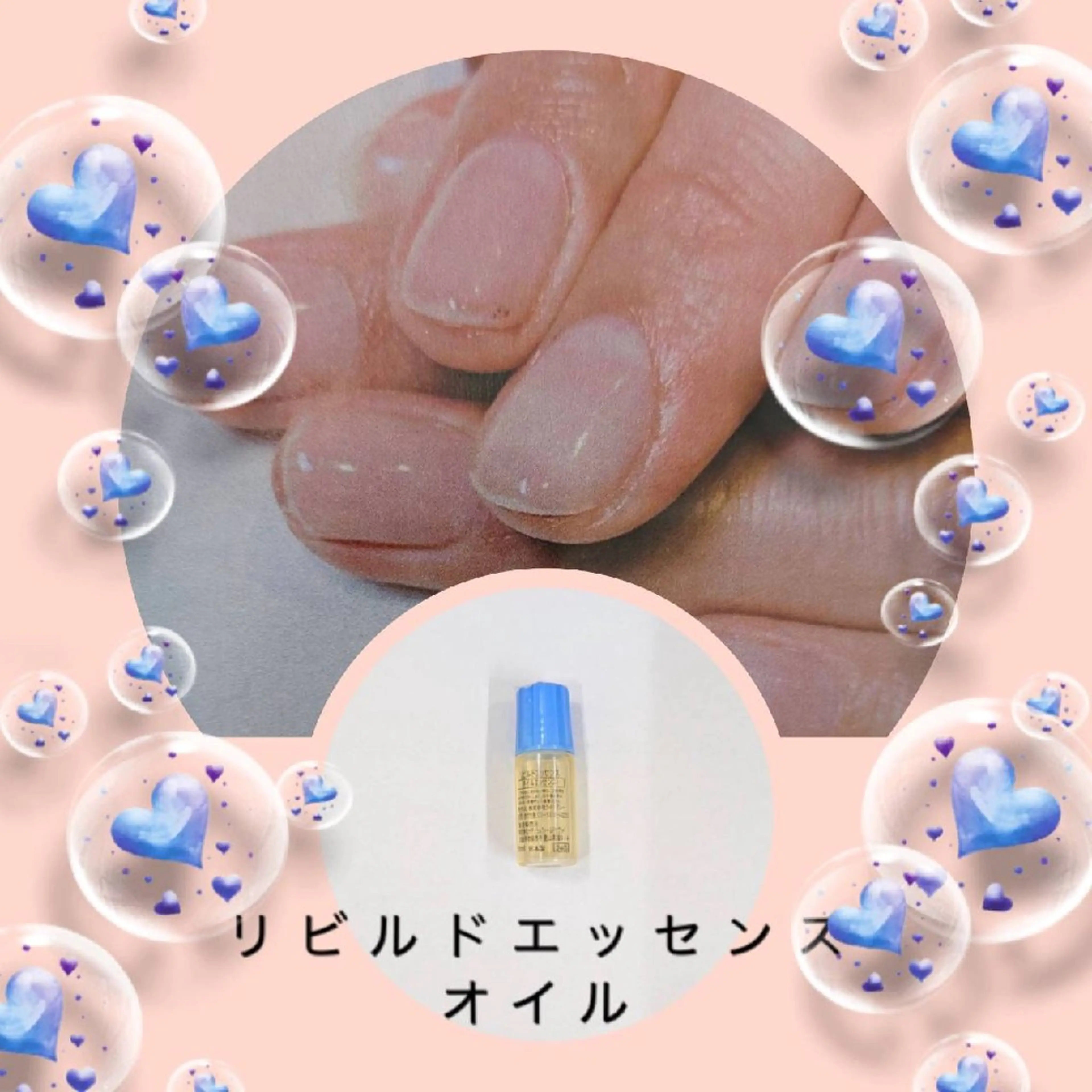 巻き爪補正店 大阪なんば店のネイルデザイン