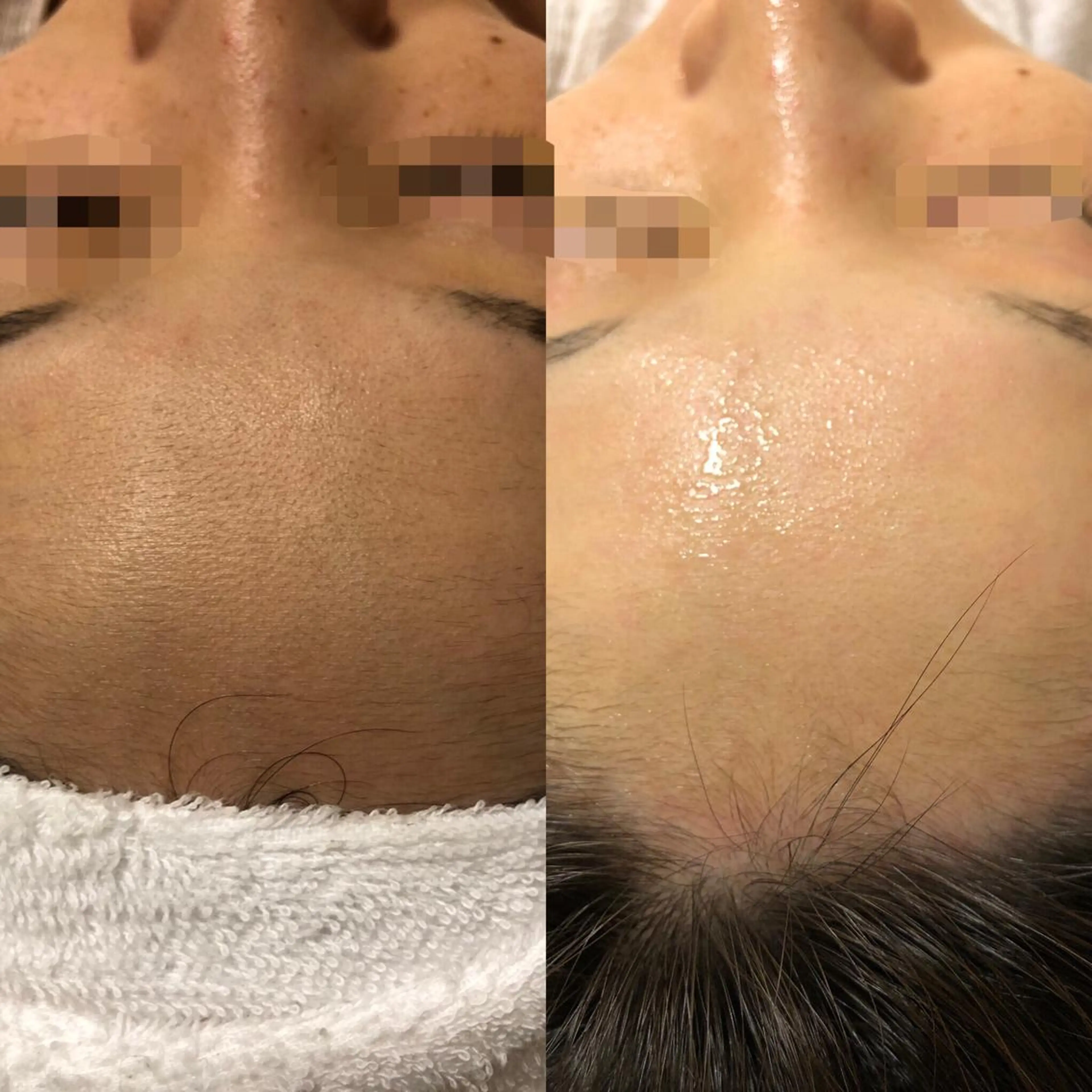 脱毛 エスカル ボーテのエステ・リラクイメージ