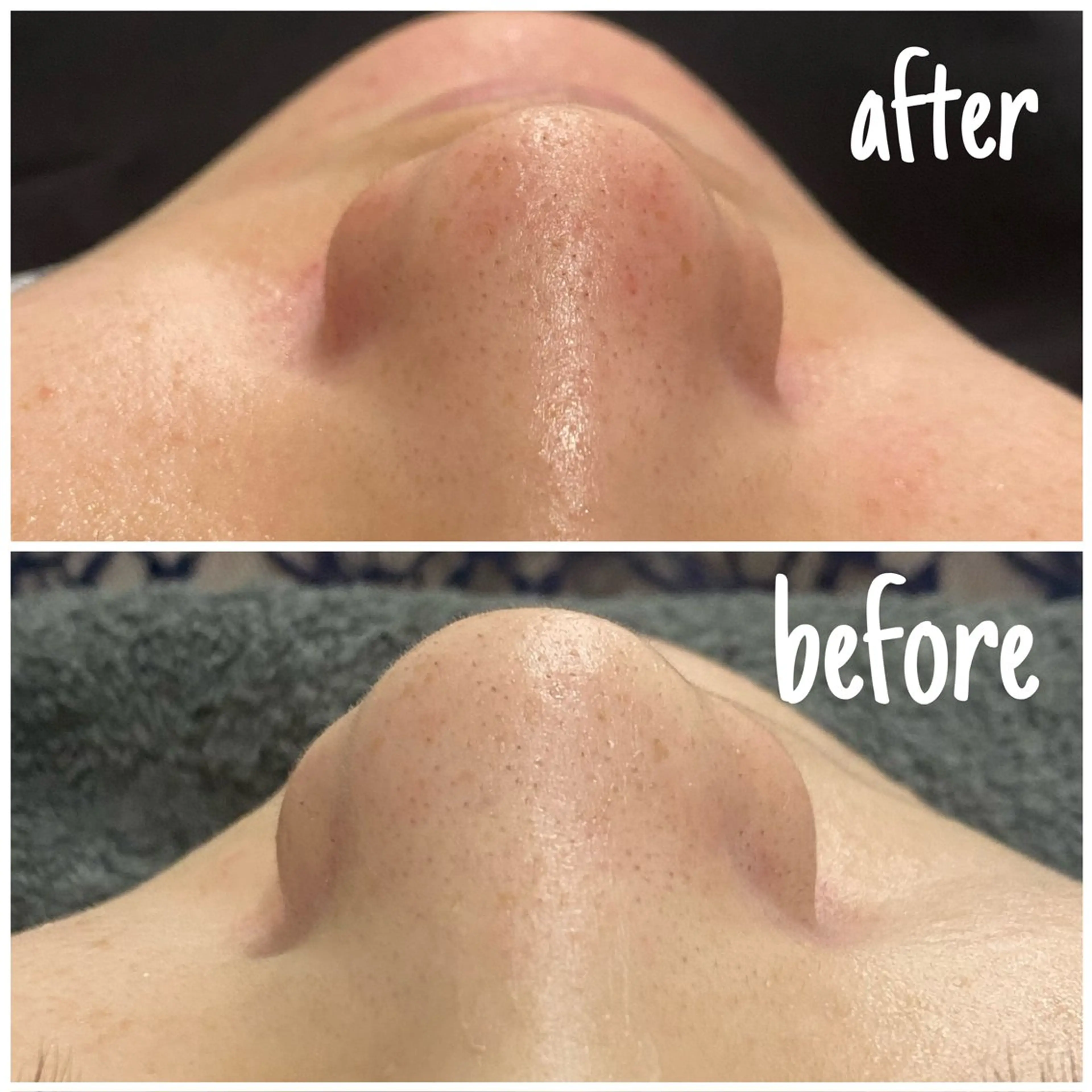 痩身/毛穴洗浄/脱毛 アルカンジュのエステ・リラクイメージ