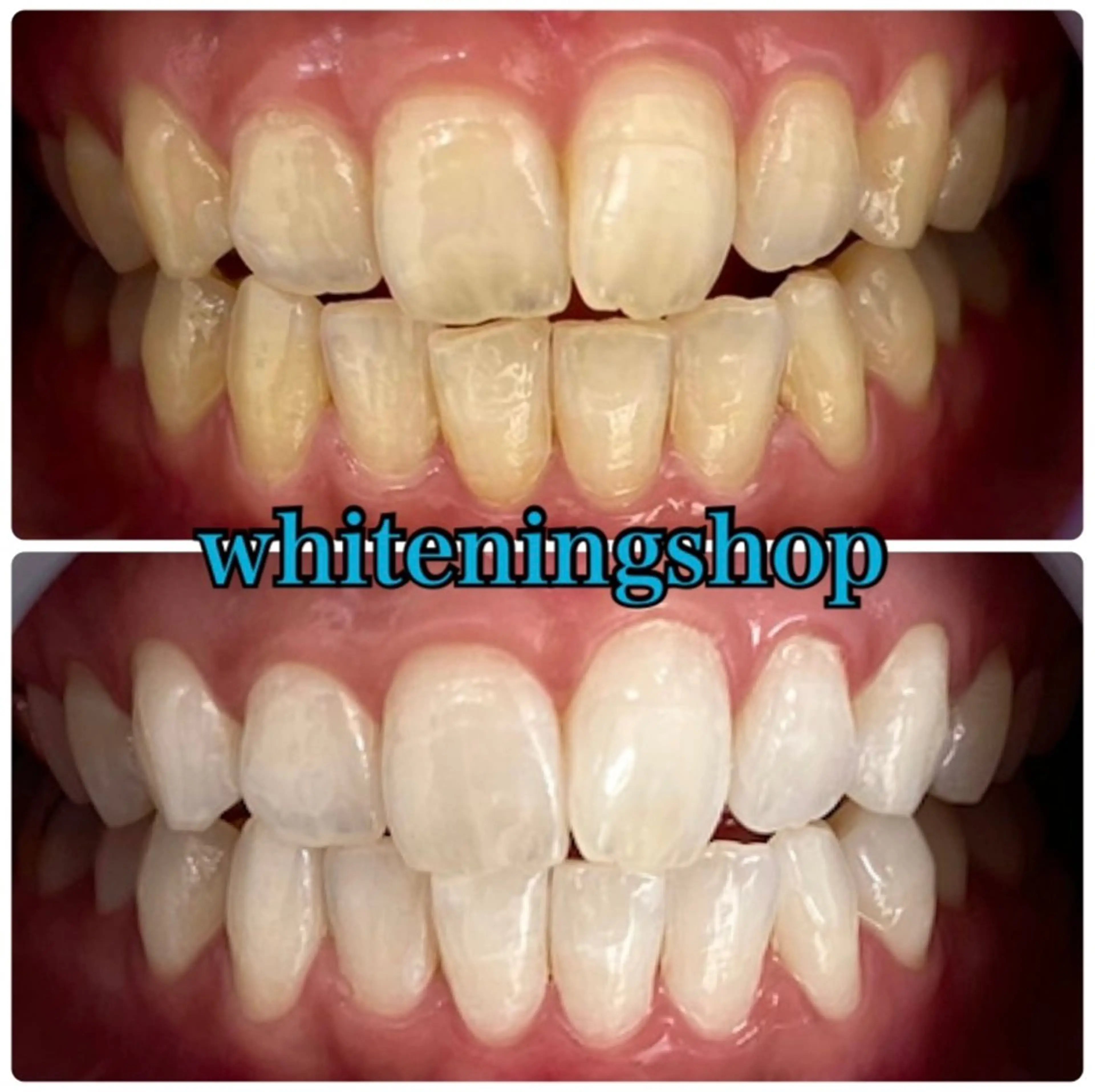 エステ リラク ホワイトニング ショップ吉祥寺店のエステ・リラクイメージ