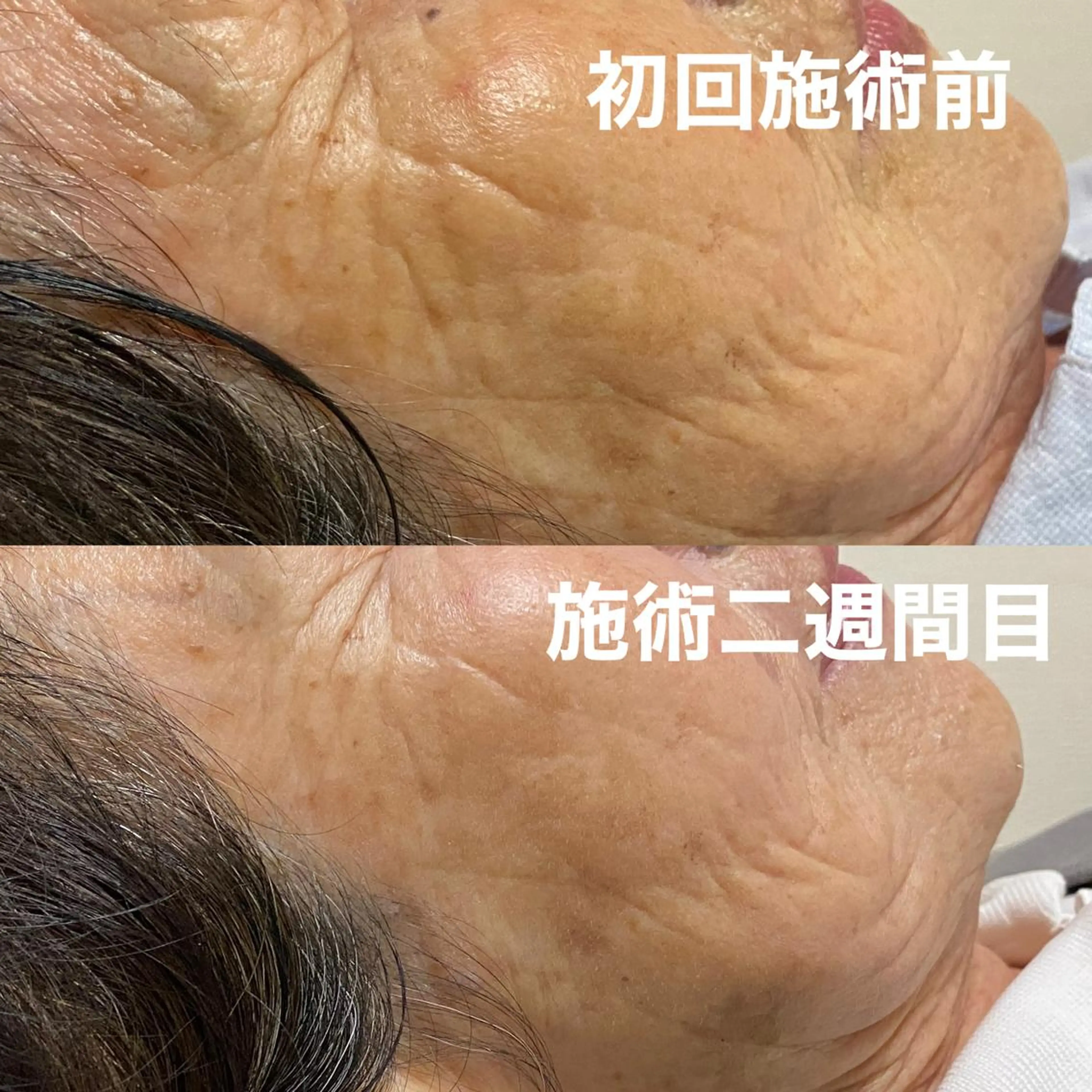 美容鍼 蕾【谷町六丁目】のエステ・リラクイメージ