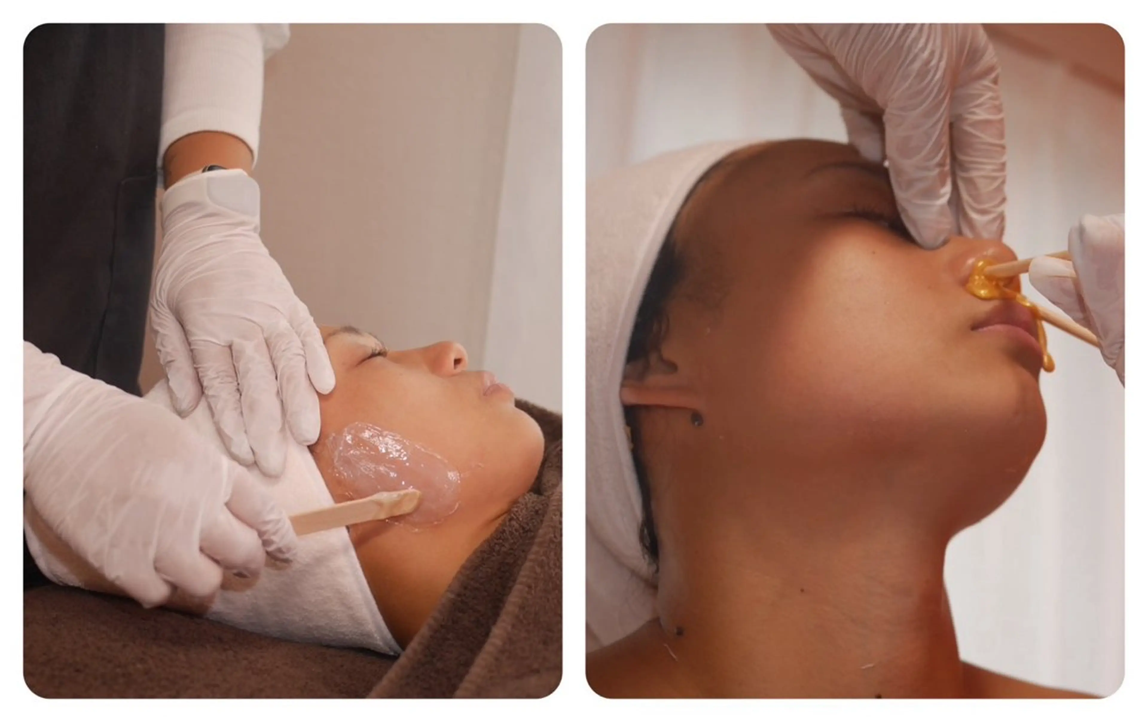 脱毛 Vonita Mikieのエステ・リラクイメージ