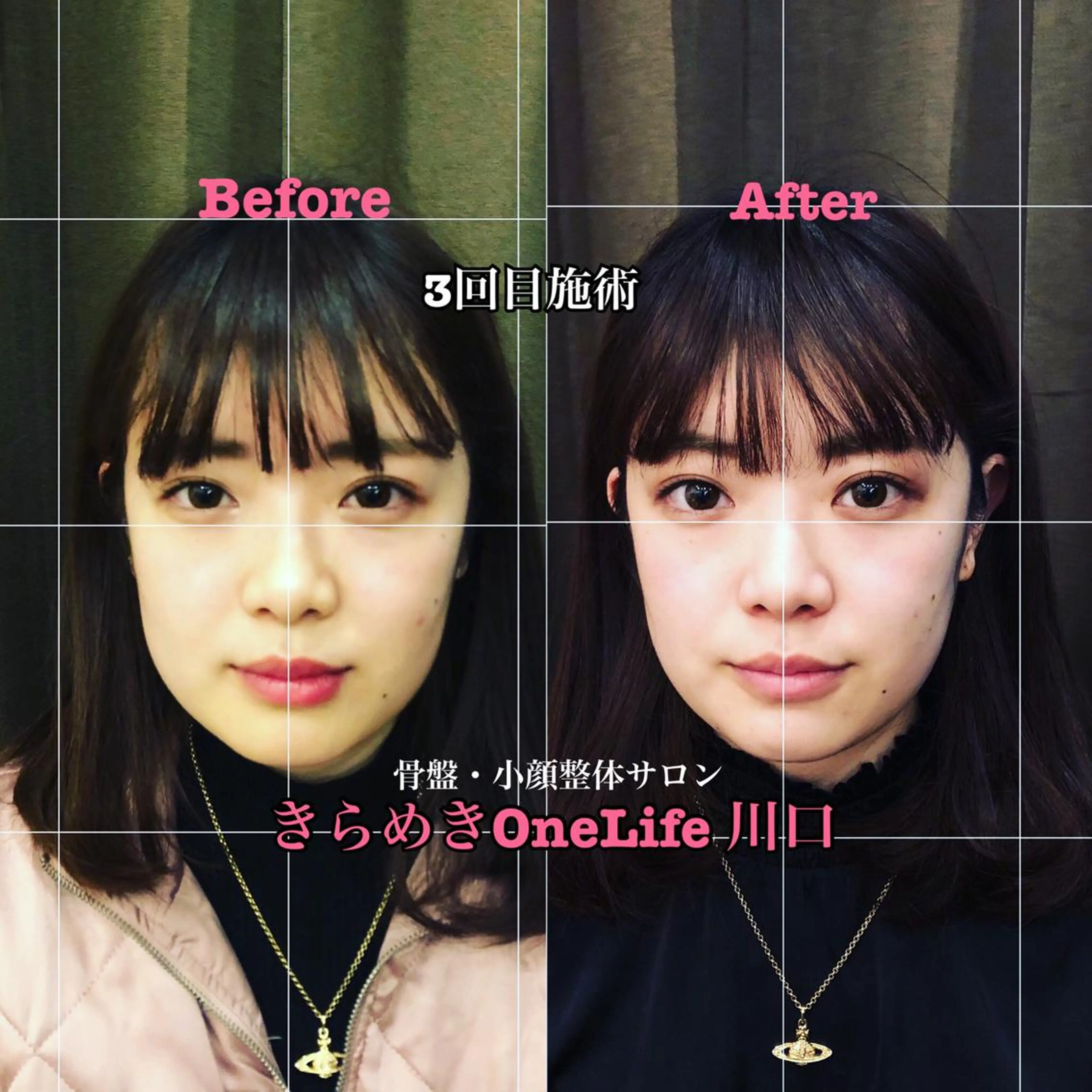 エステ リラク きらめきワンライフ Yumaのエステ・リラクイメージ