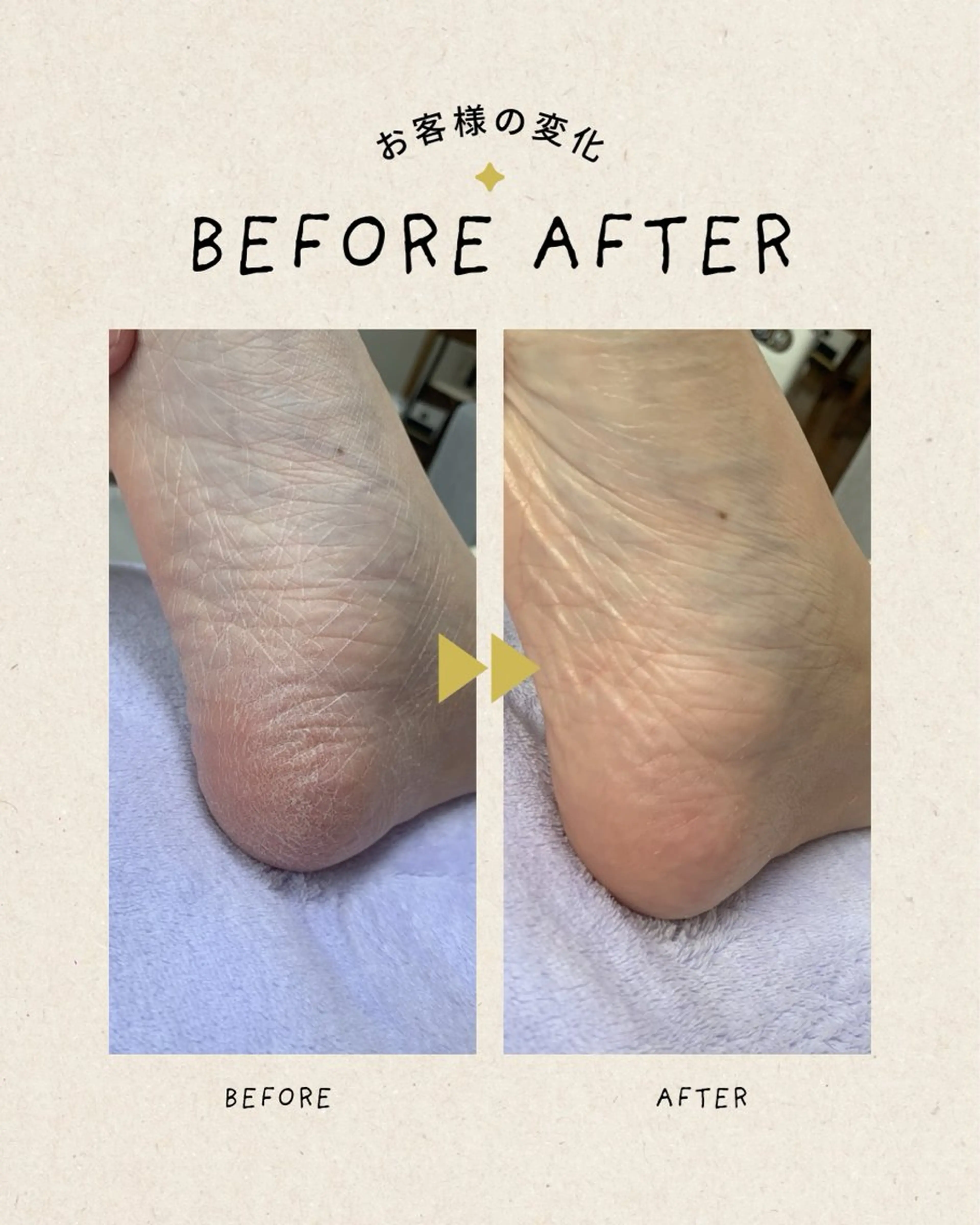 足トラブル専門 ニコルル金沢のエステ・リラクイメージ