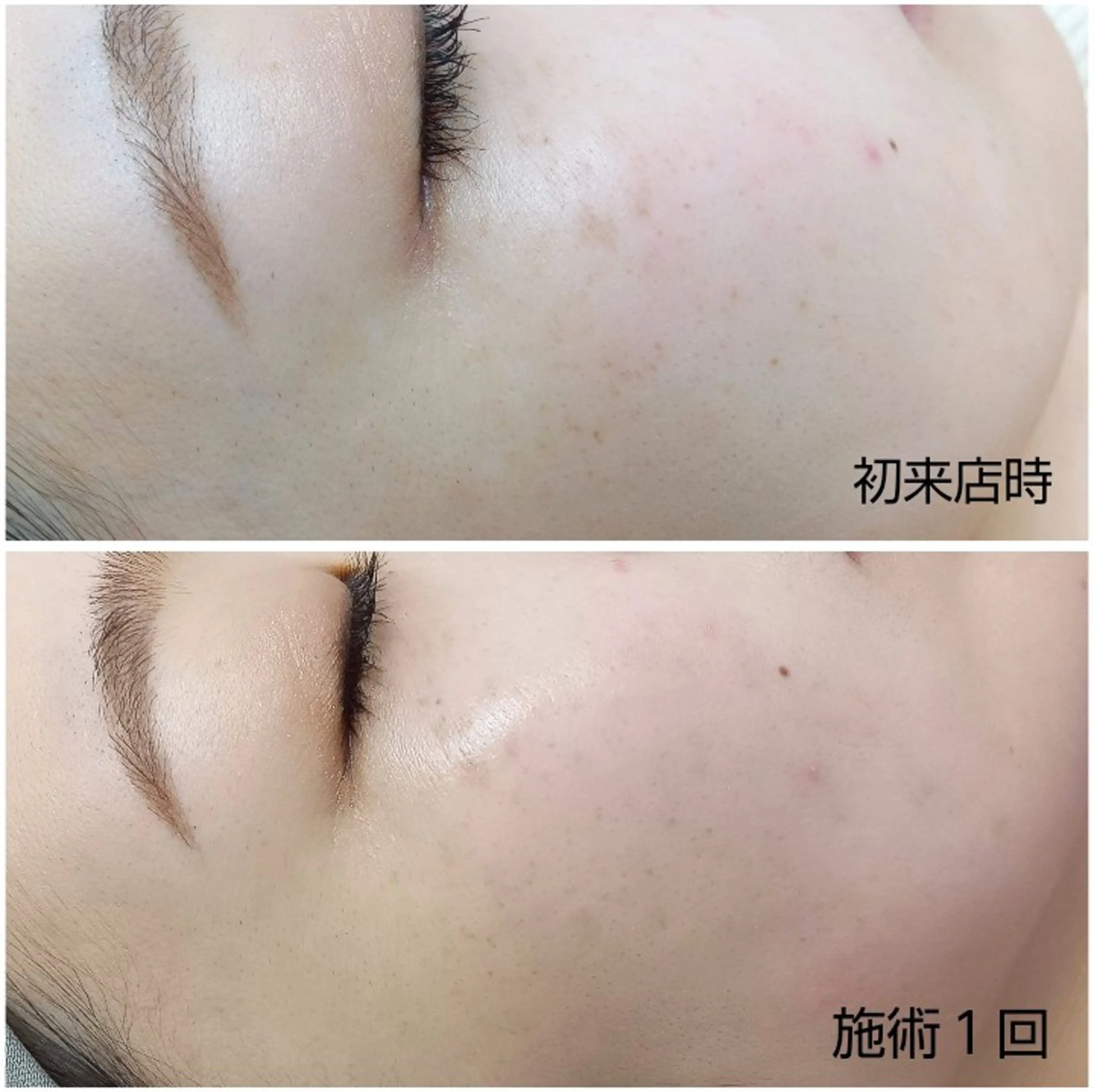 シミケア専門店 HAQUAのエステ・リラクイメージ