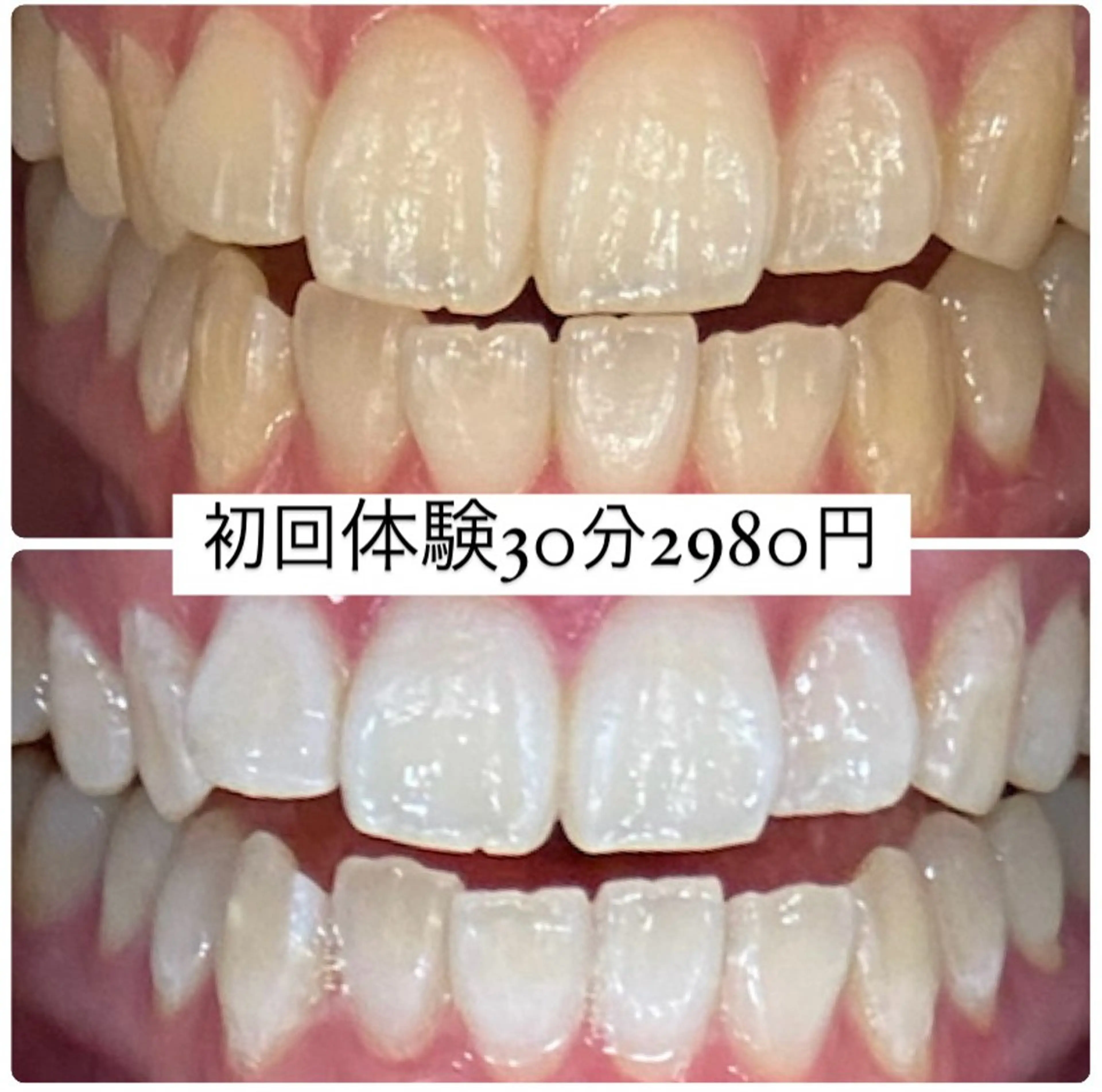 ホワイトニングルーム 横浜店のその他イメージ