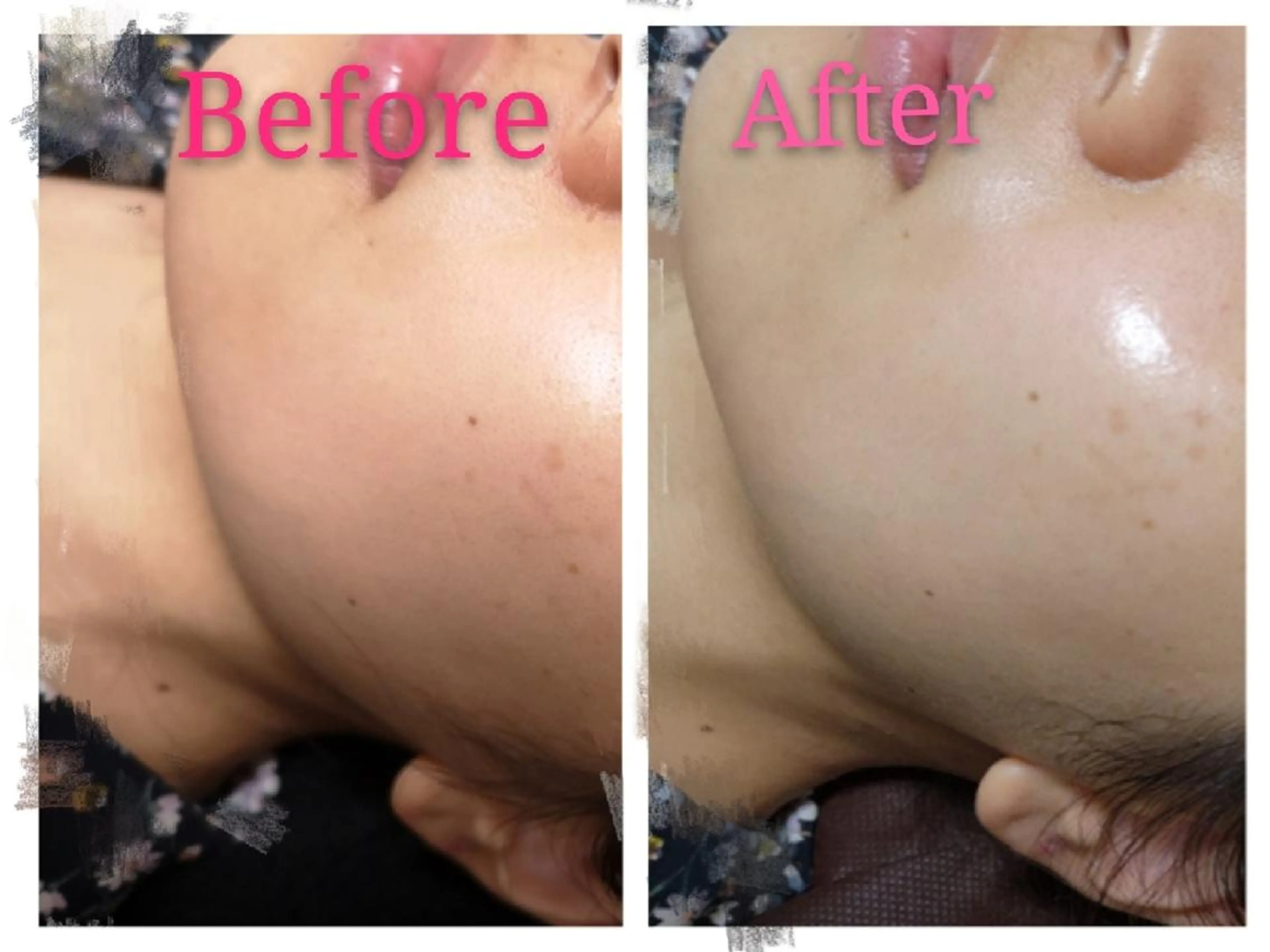 🅖🅤🅩🅔🅛 salonのエステ・リラクイメージ