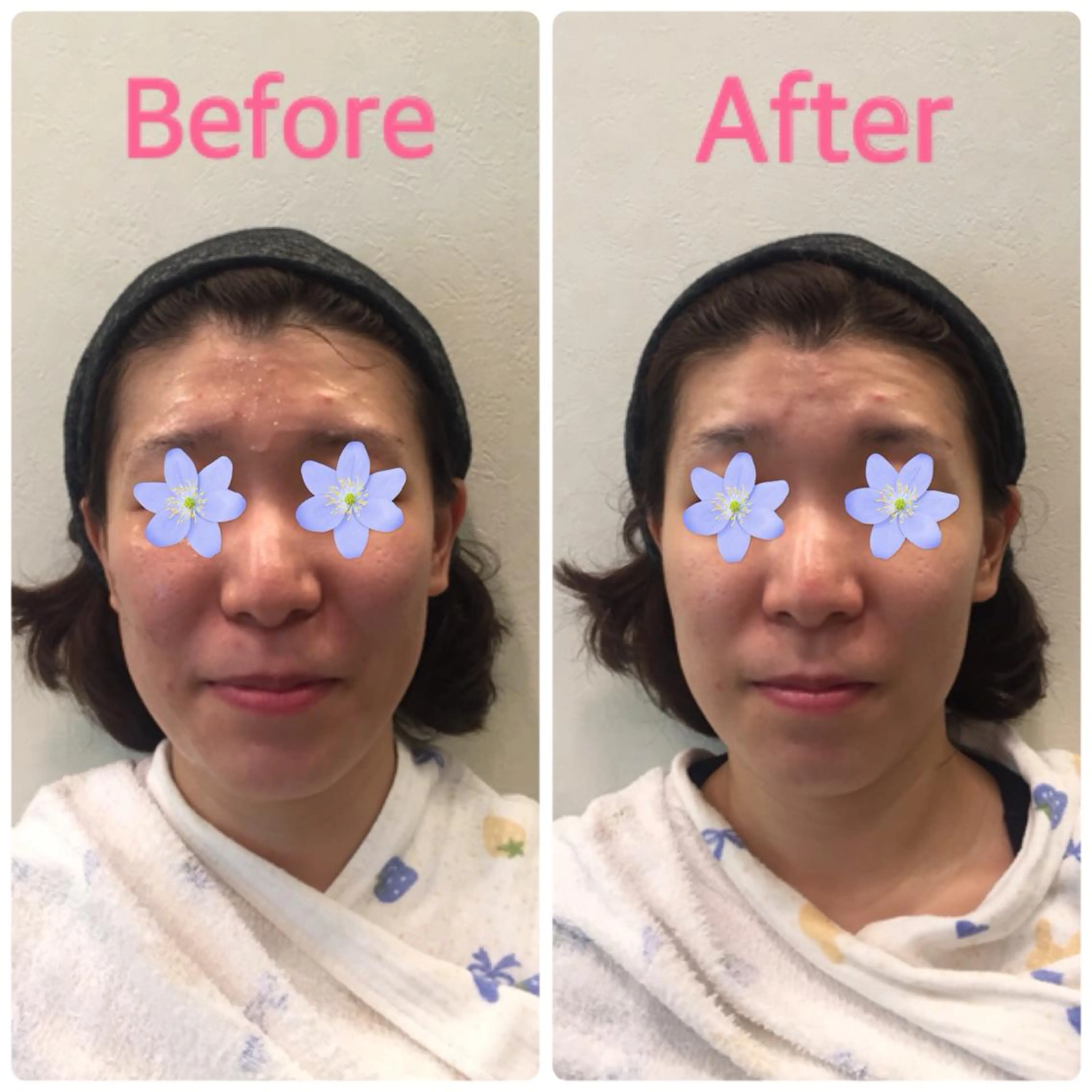 DeCoLé Beauty所属・艶肌/敏感肌/若さ/ ボディ痩身🌿のエステ・リラクイメージ