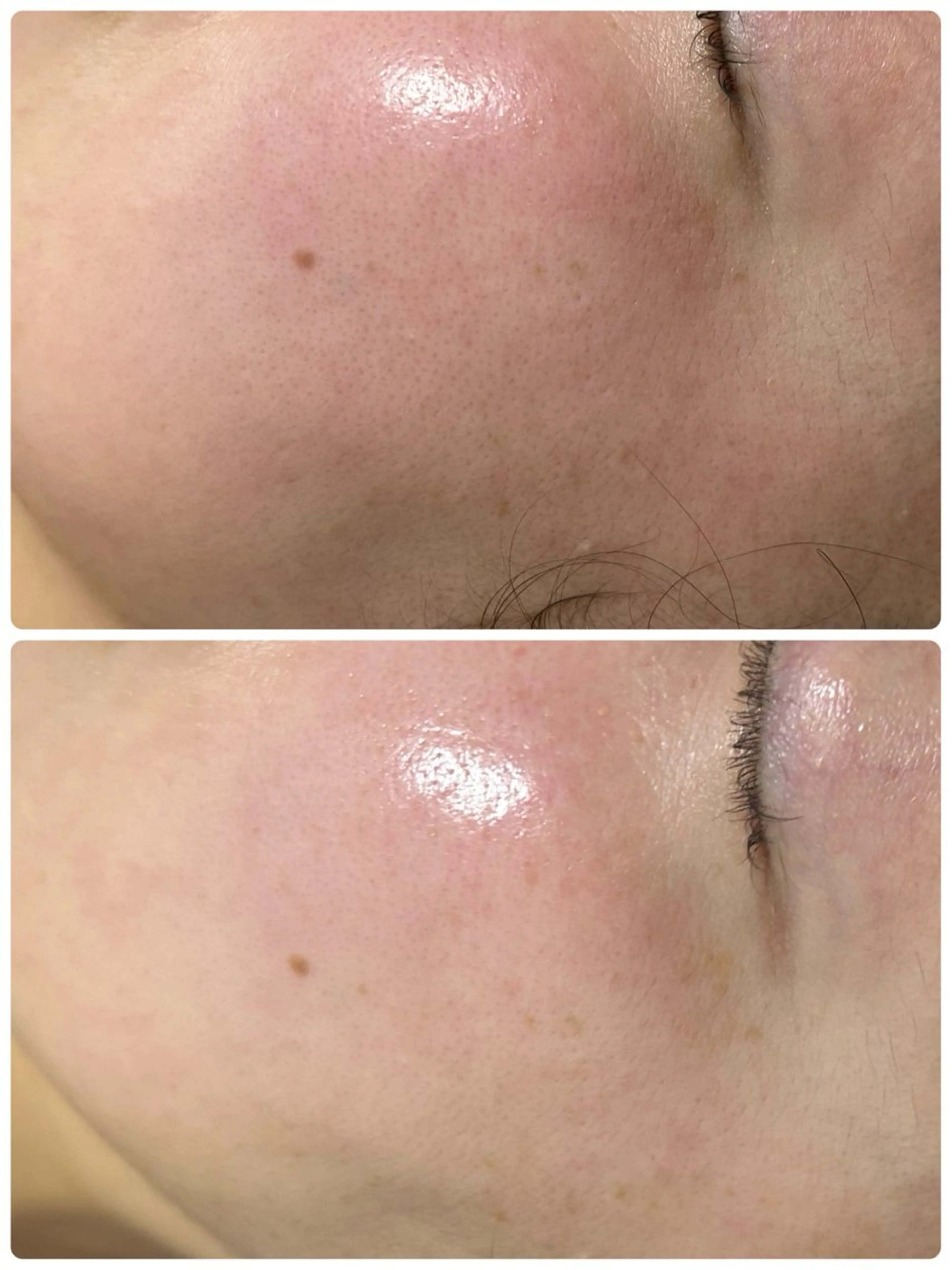 その他 小顔美肌痩身サロン Ranのその他イメージ