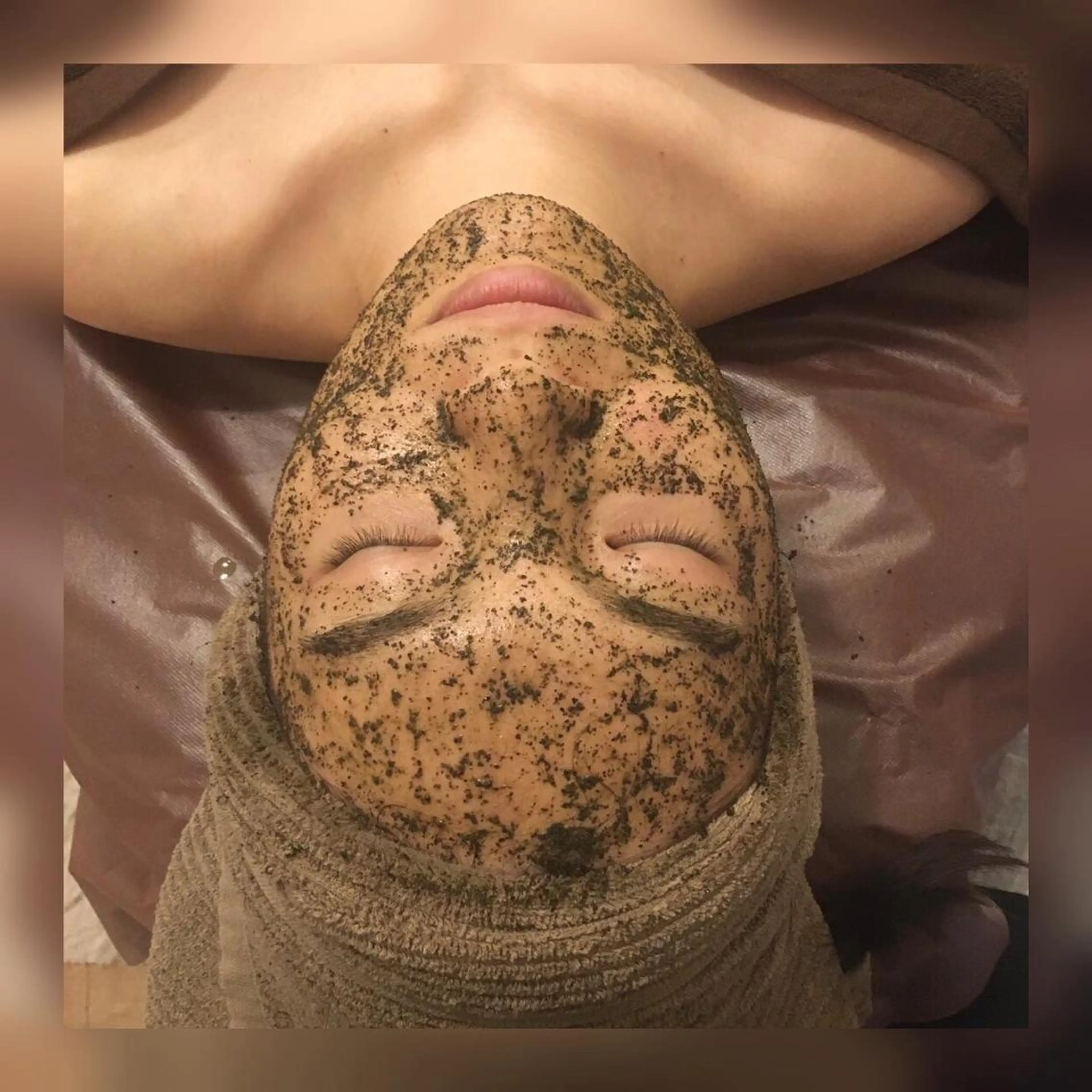 マツエク・マツパ エステ ニキビ・毛穴改善 🌿ハーブピーリングのエステ・リラクイメージ