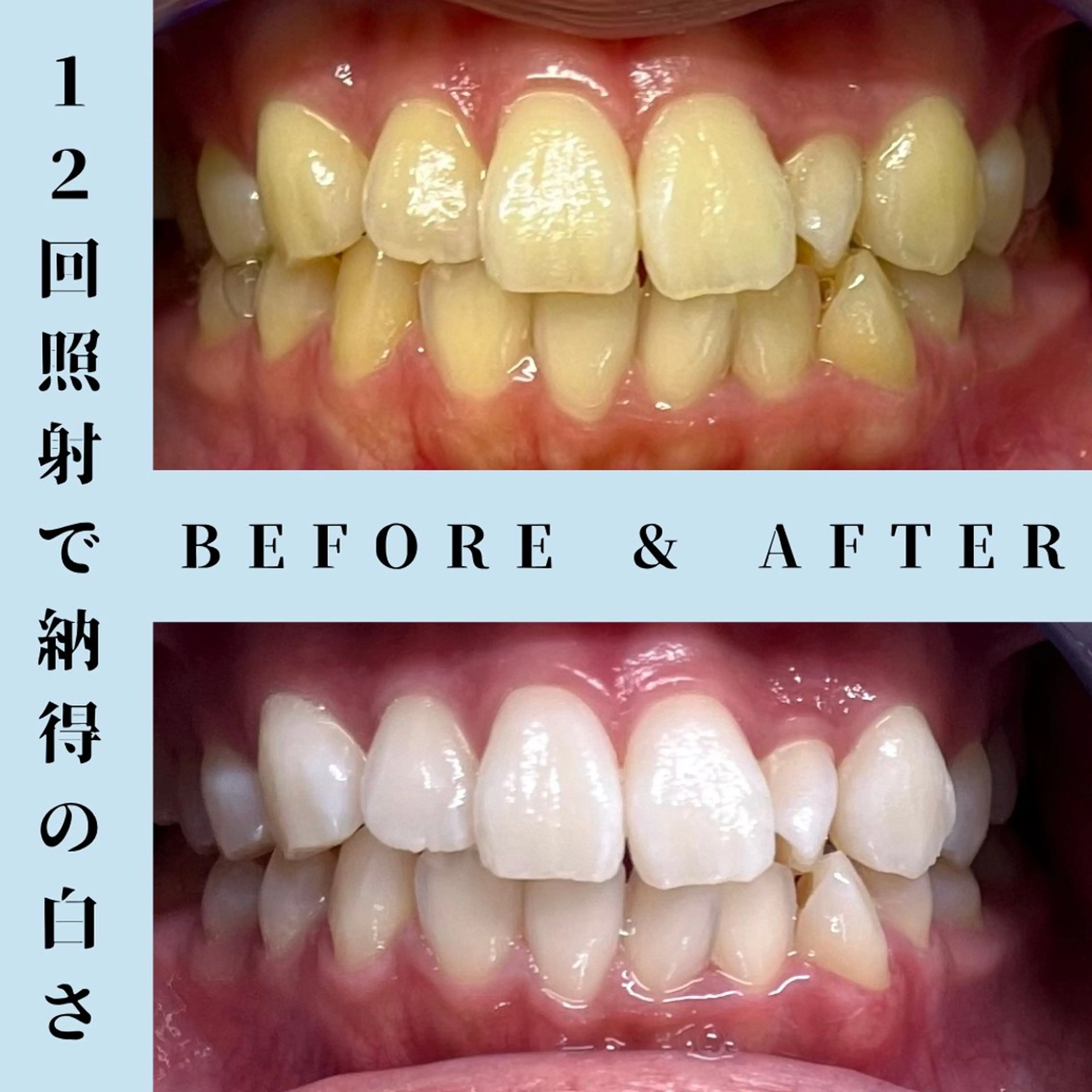 その他 セルフホワイトニング Dolce水戸店のその他イメージ