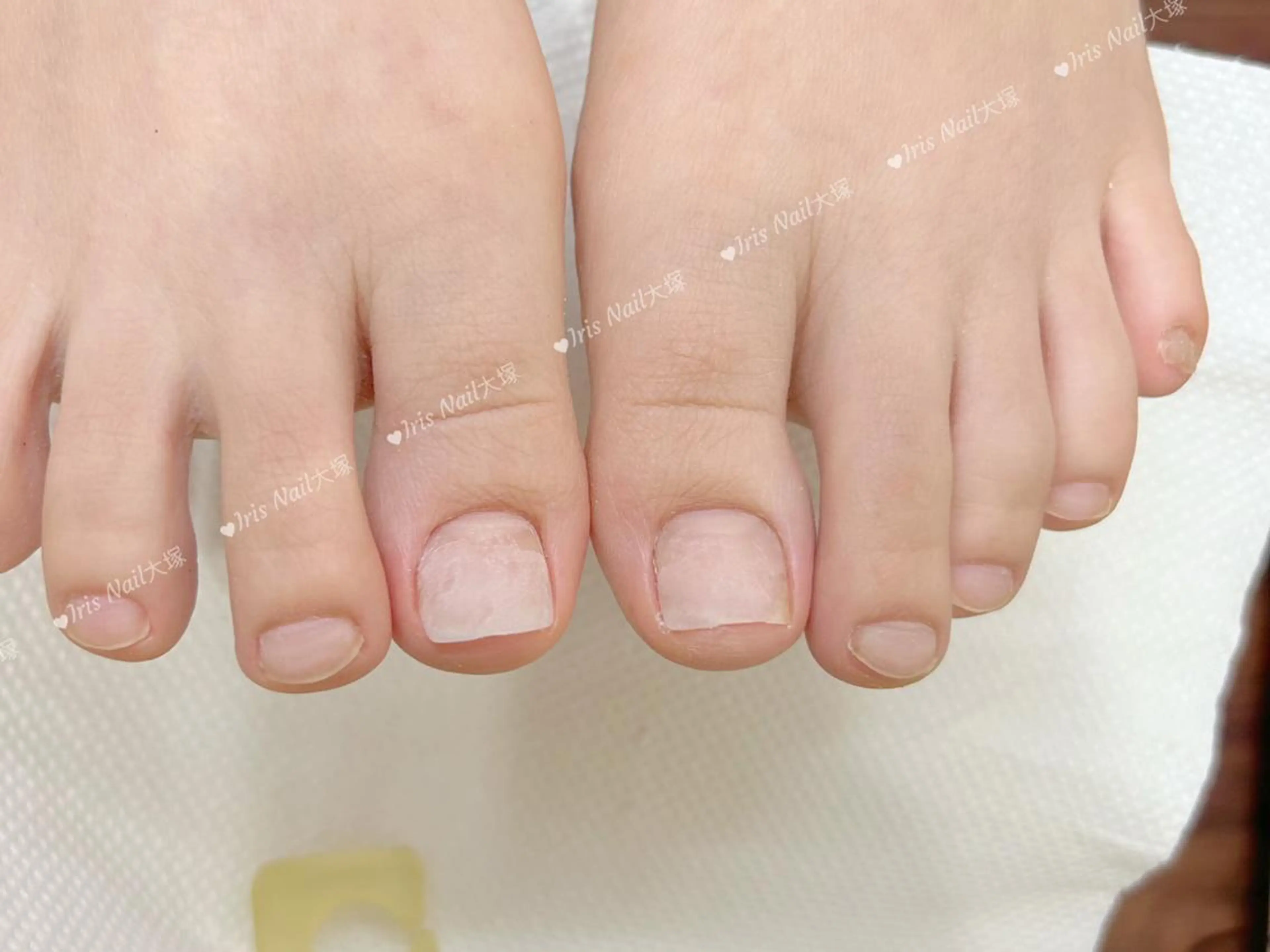 ネイル フットネイル 🍒IRIS Nail🌸のネイルデザイン