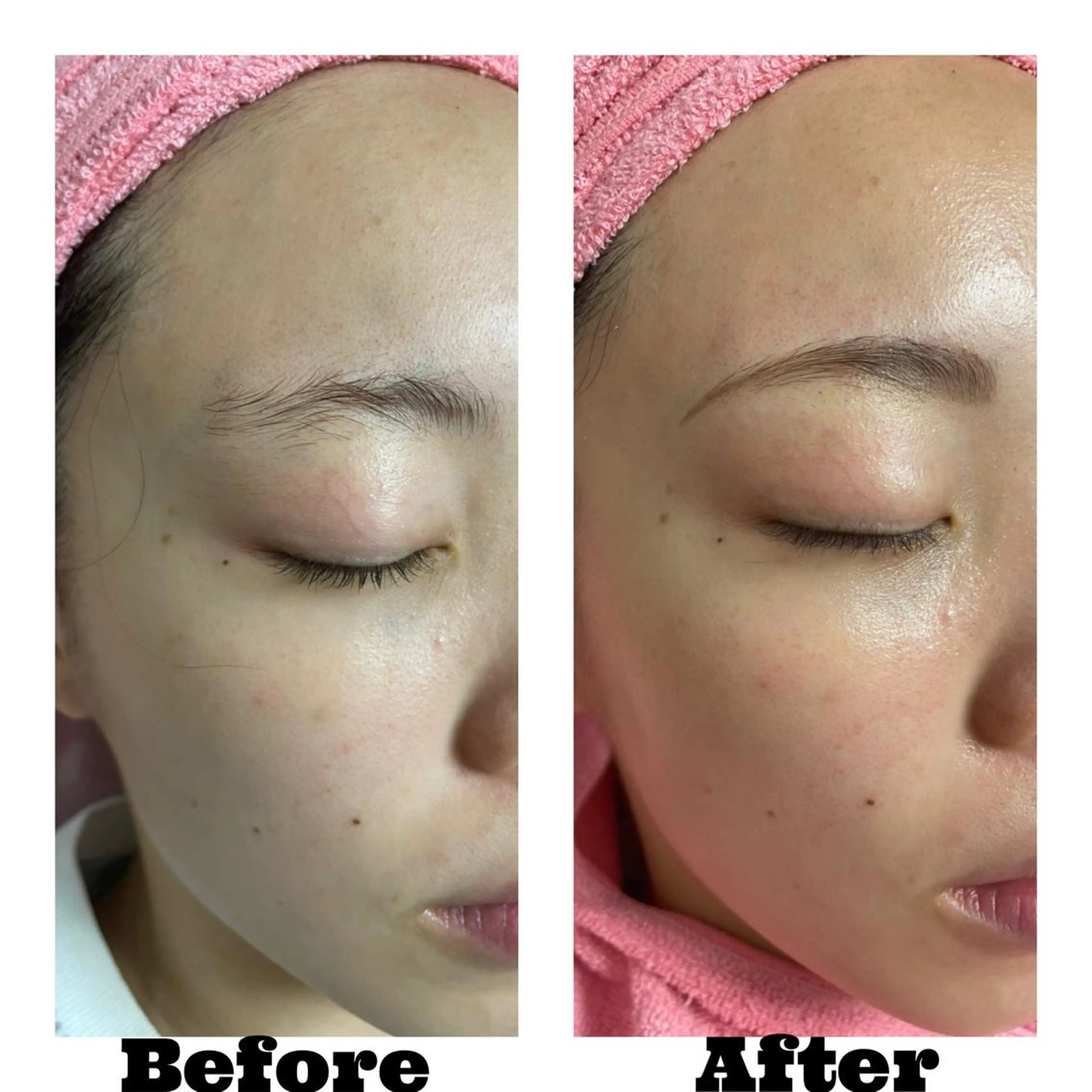 アイブロウ Linomalie エステ/たるみ/脱毛のエステ・リラクイメージ