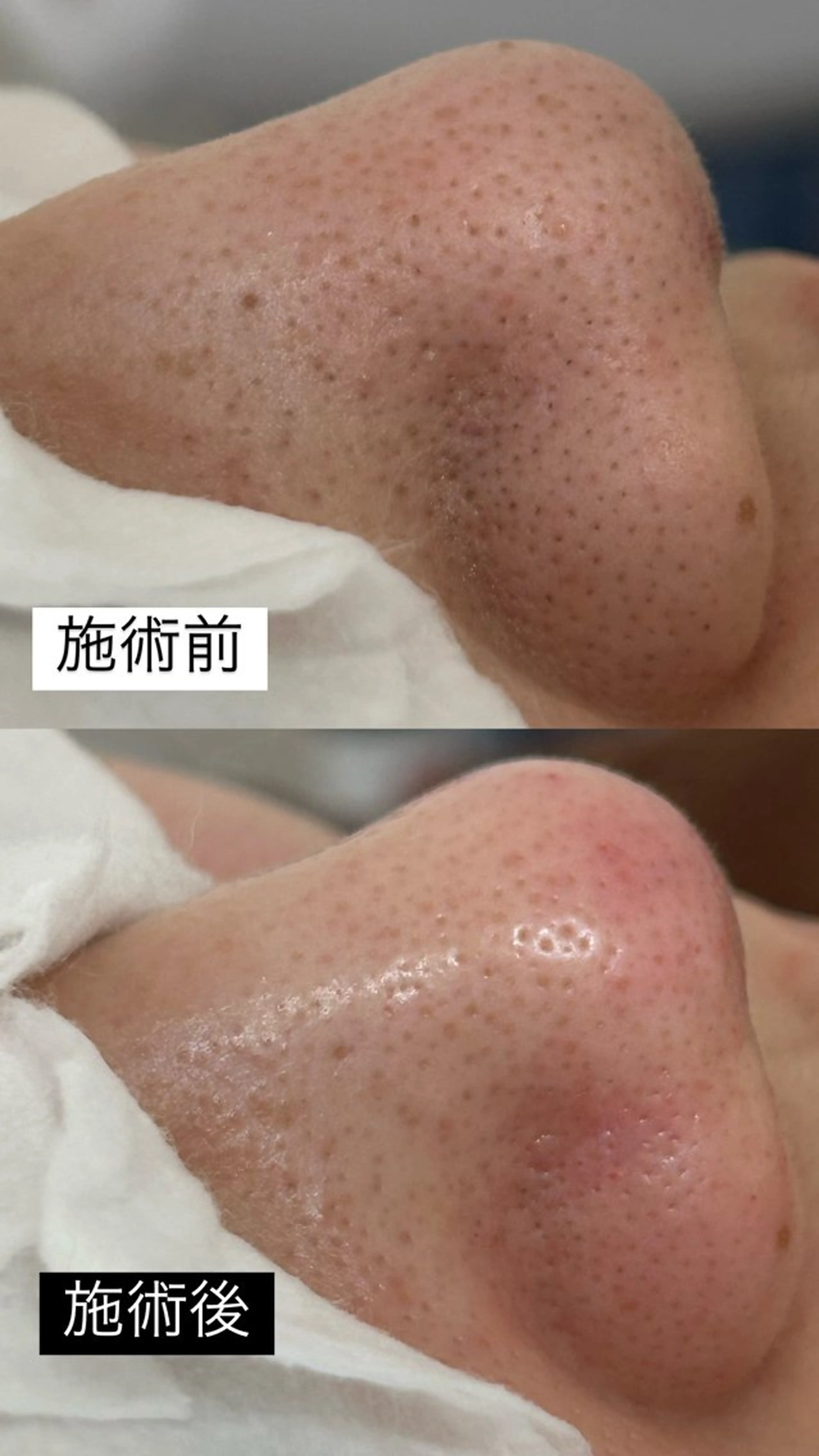 佐藤 明香のマツエク・マツパデザイン