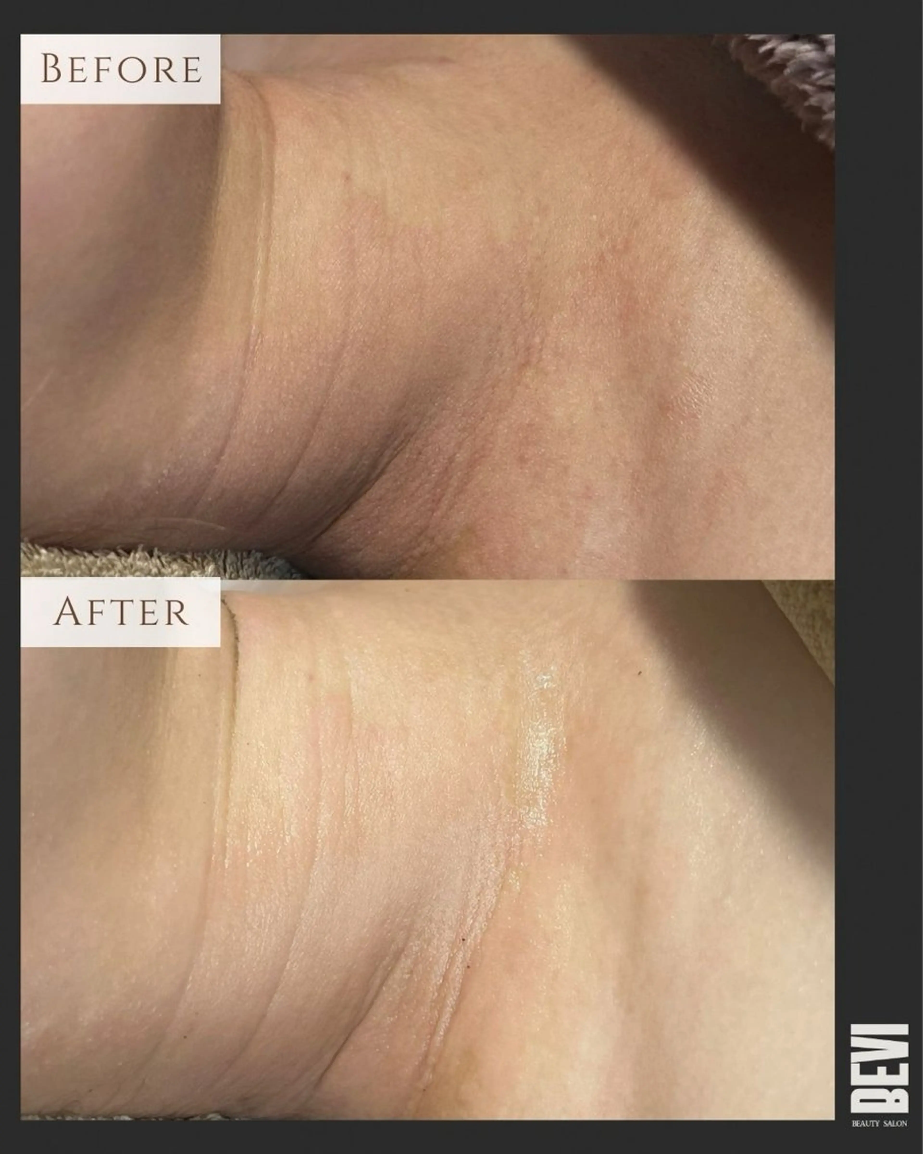 エステ Bevi salonのその他イメージ