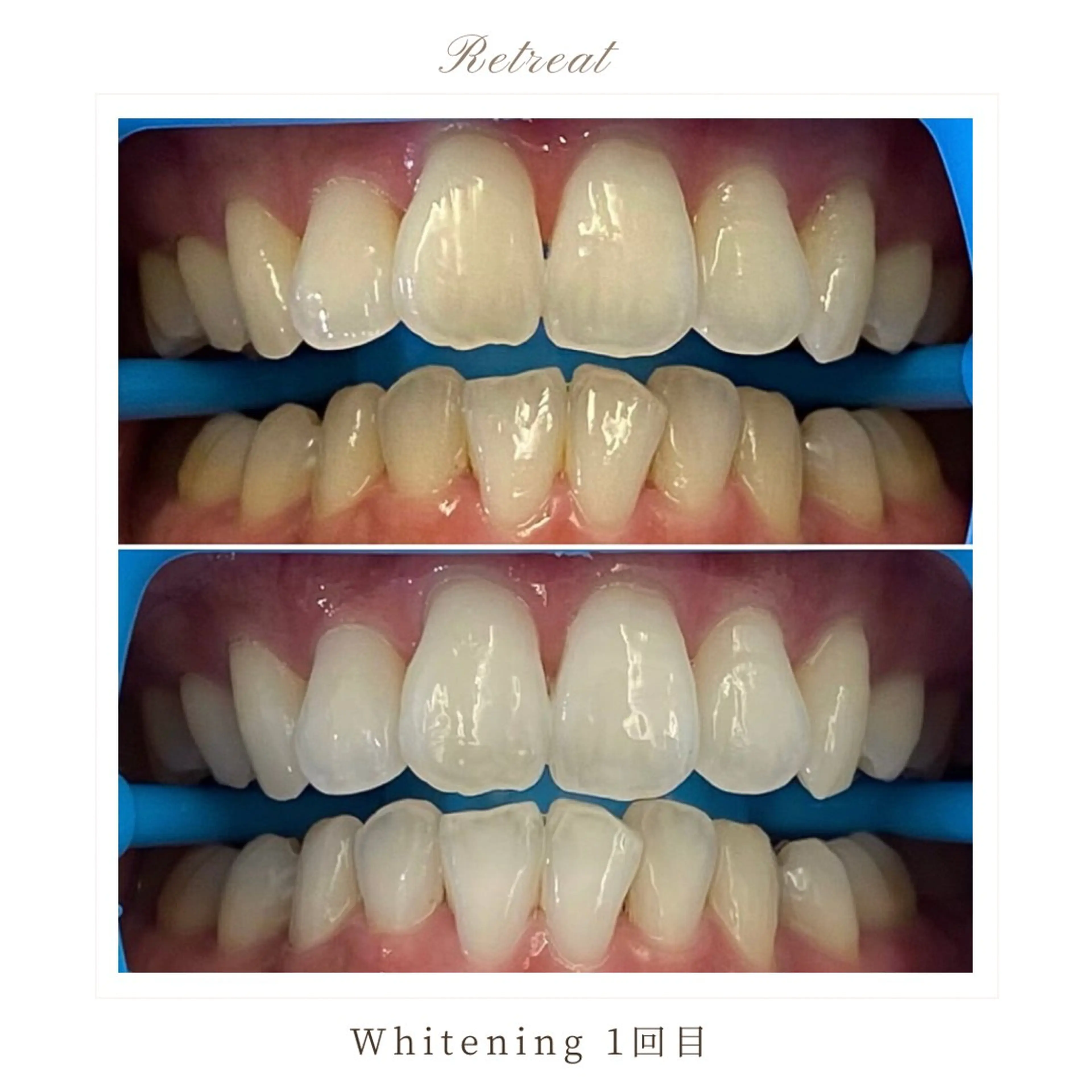 歯科医院提携 Retreatのエステ・リラクイメージ