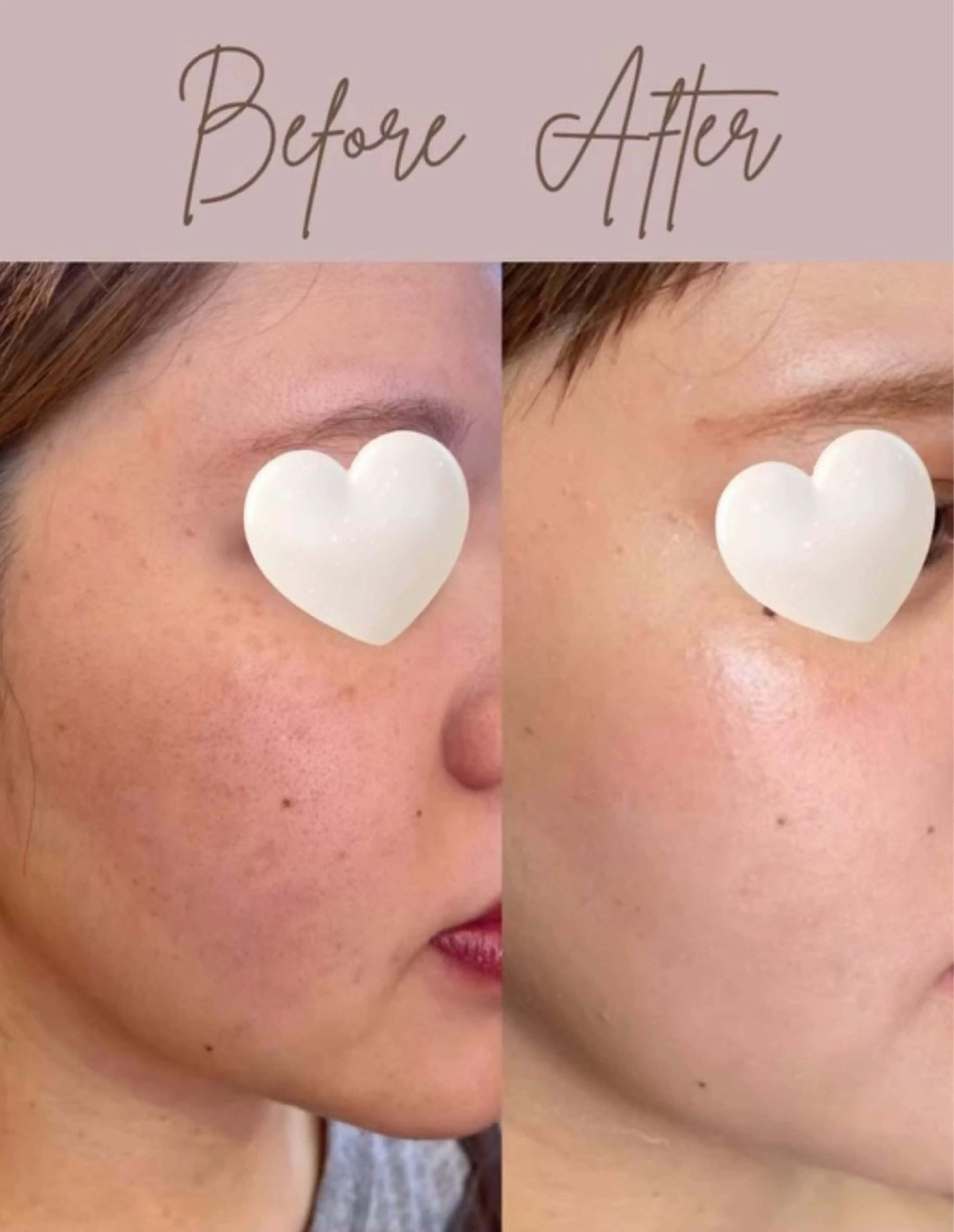 salon merci和泉のエステ・リラクイメージ