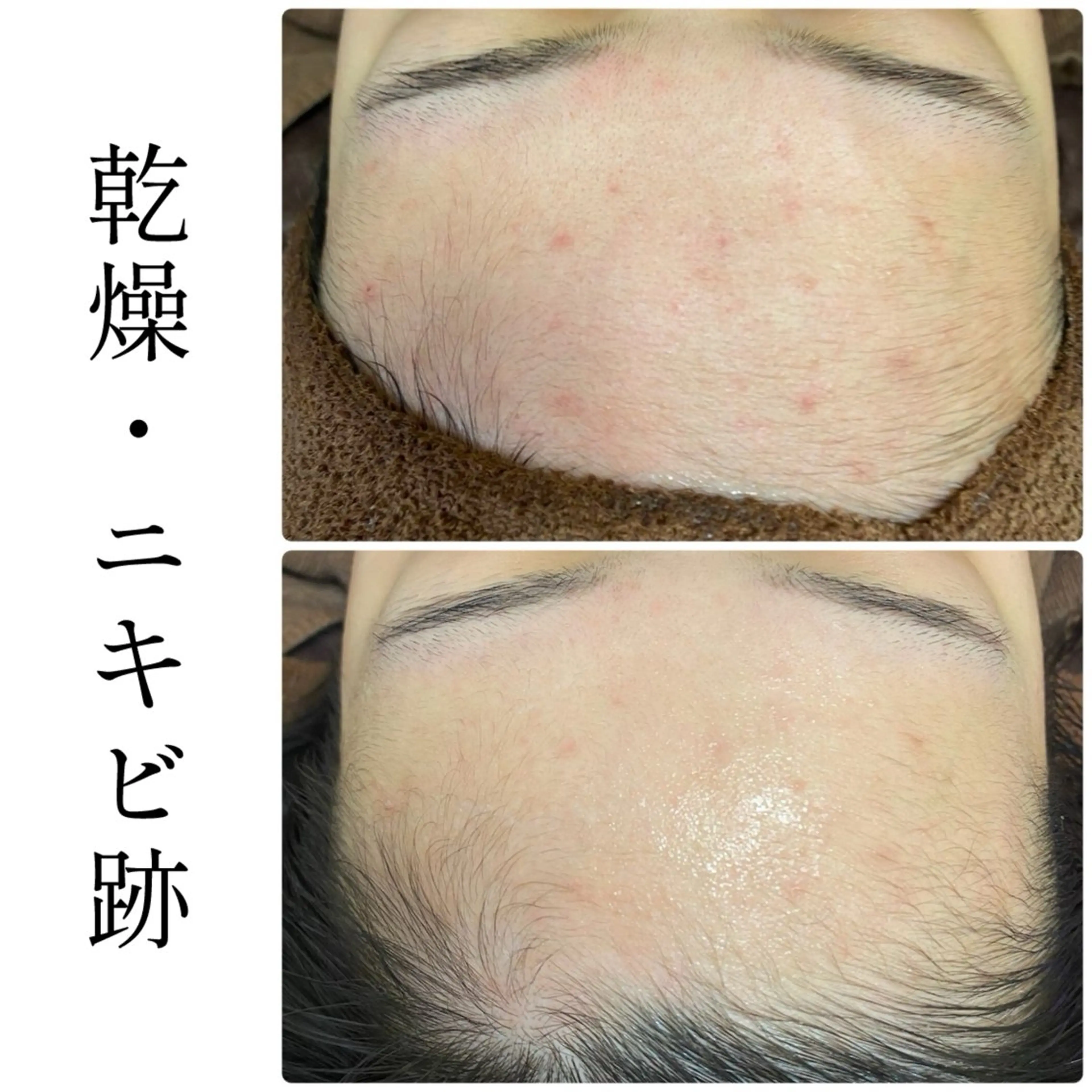 エステ ハーブピーリング専門 BIOEL横浜のエステ・リラクイメージ