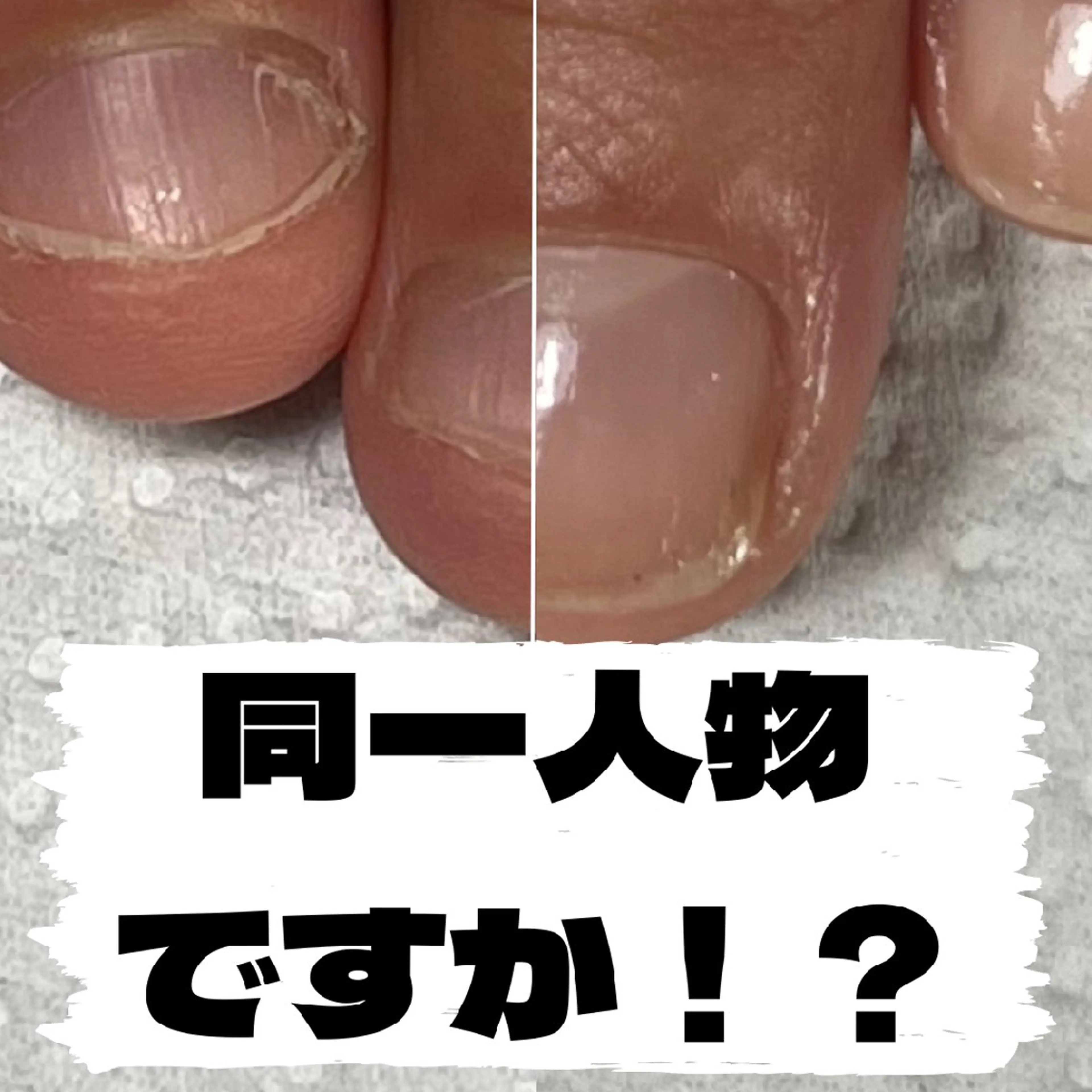 ネイル nail 1623のネイルデザイン
